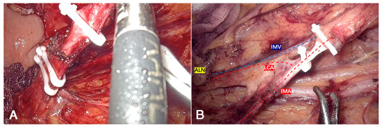 Cancers 17 02389 g0a1