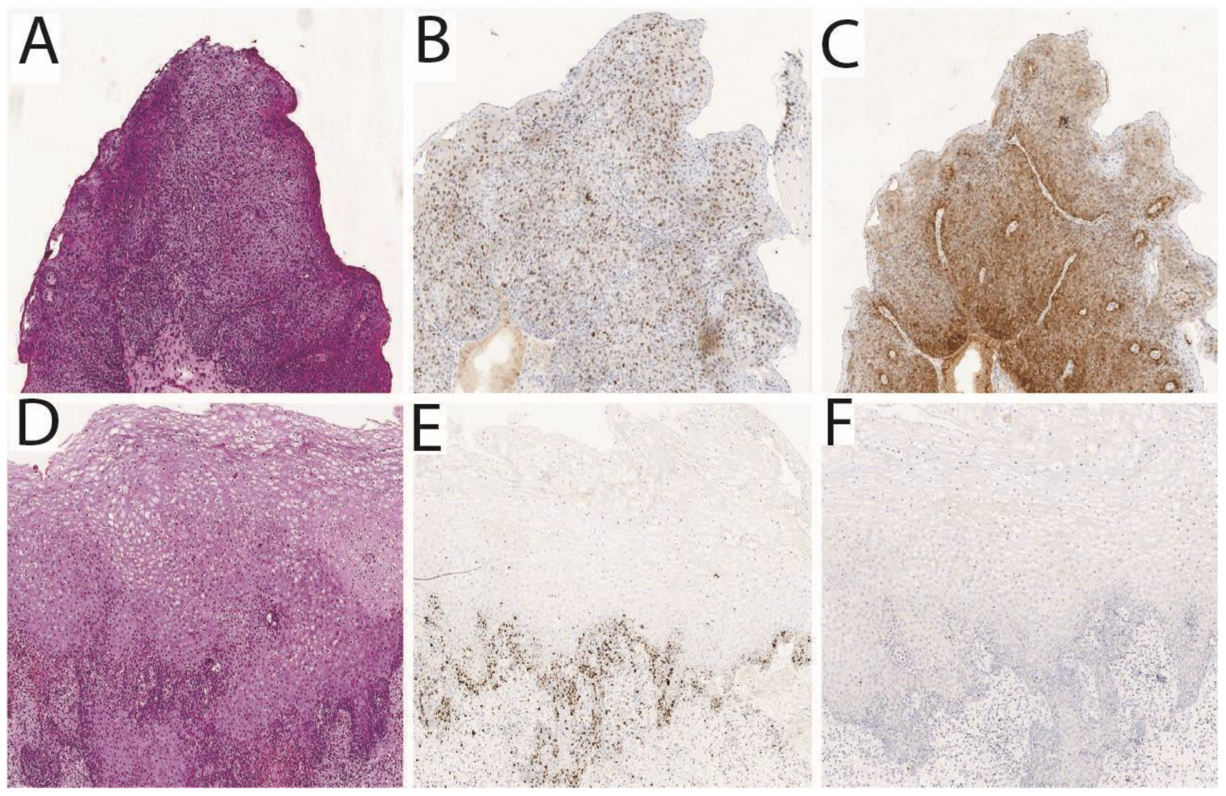 Cancers 17 02421 g004