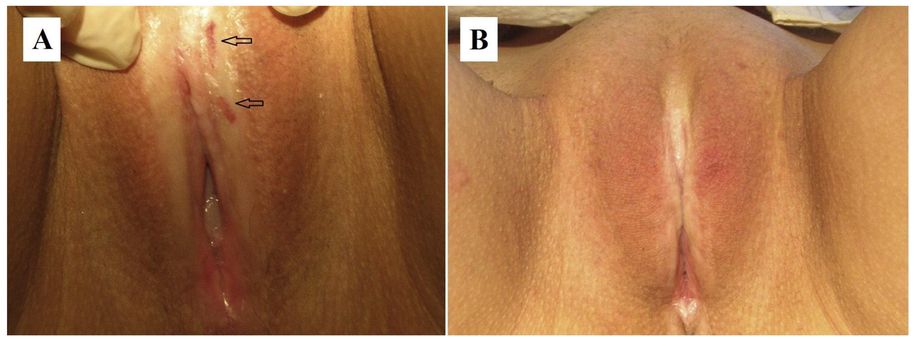 Cancers 17 02421 g007