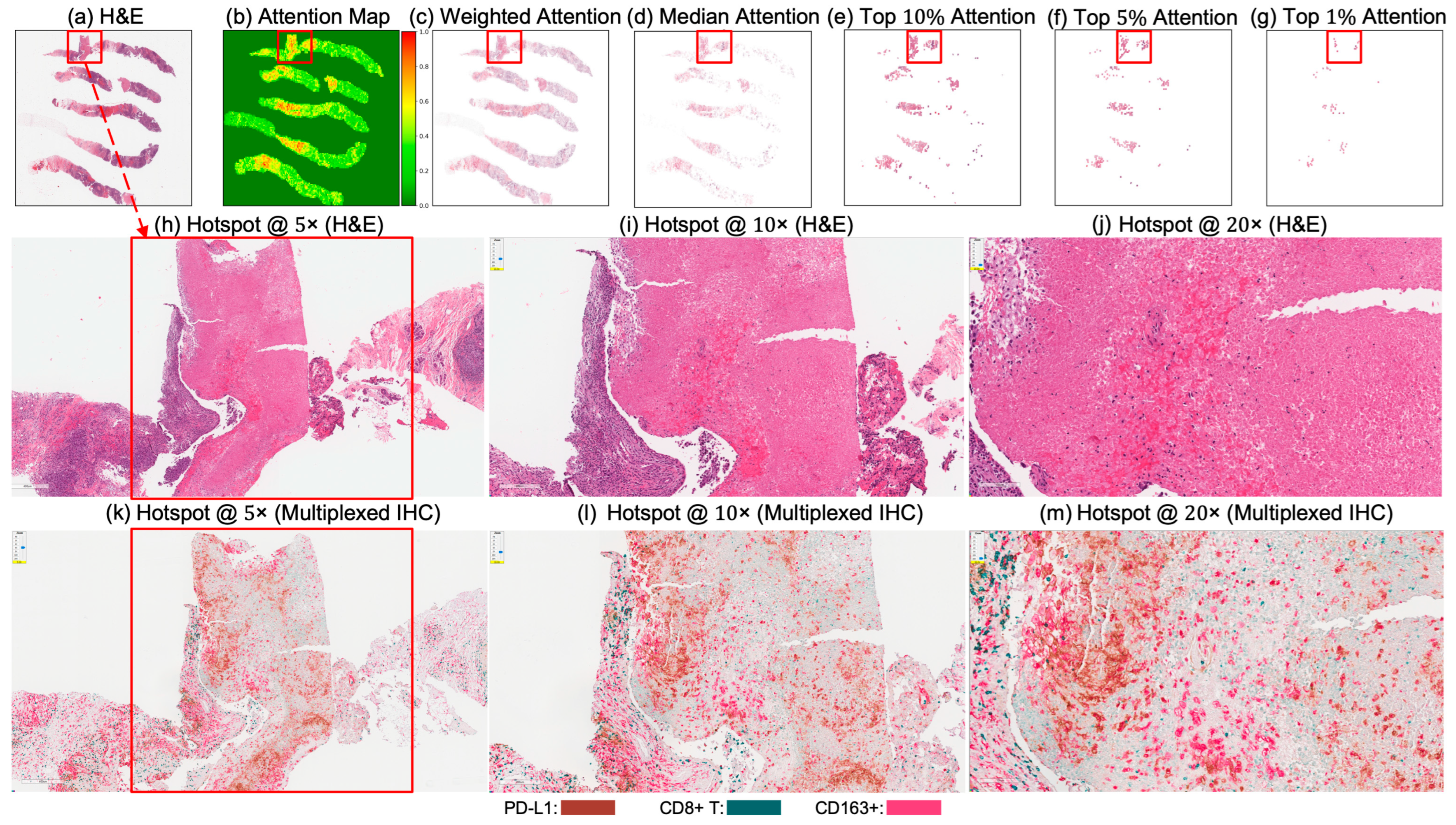 Cancers 17 02423 g004