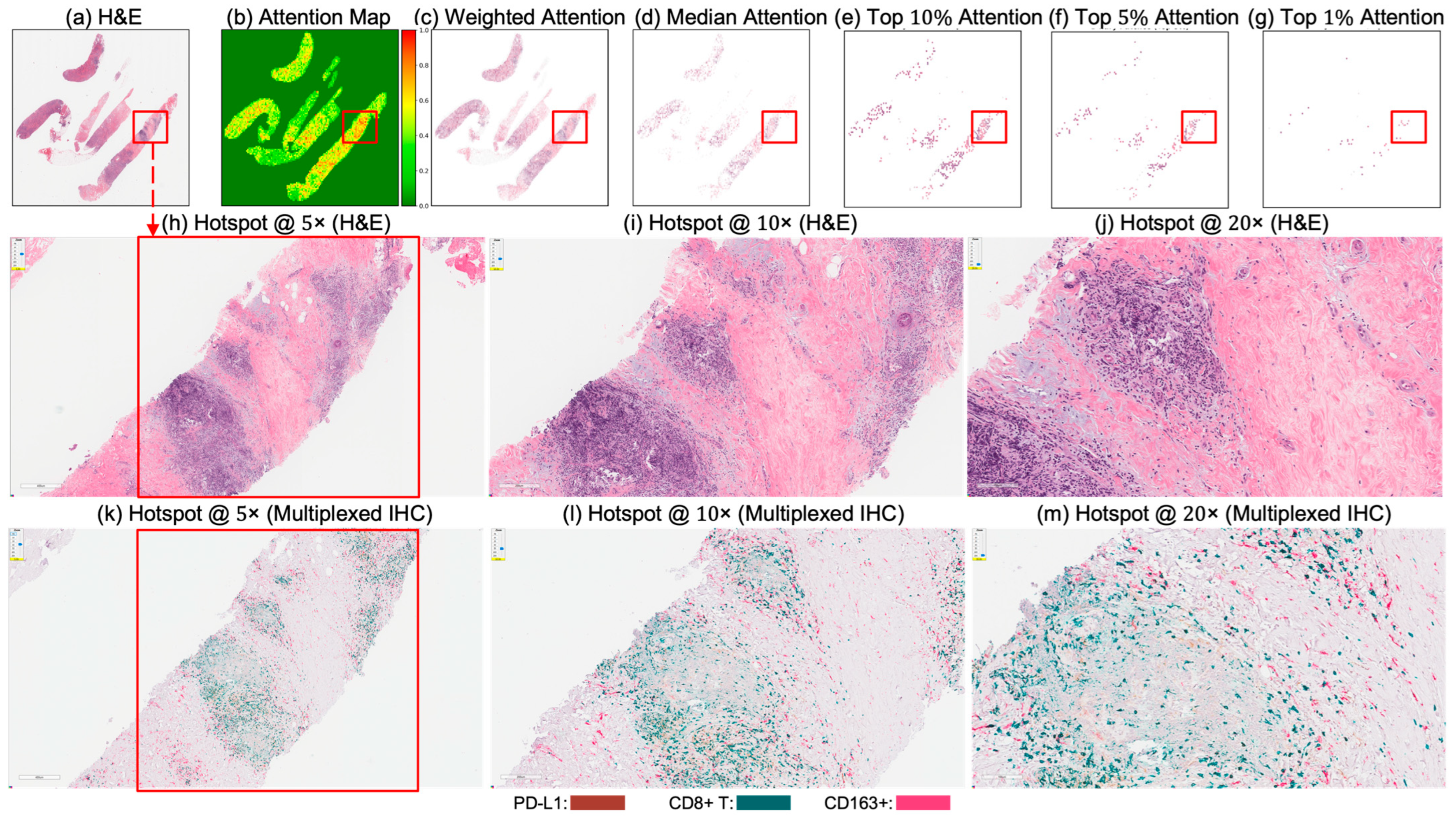 Cancers 17 02423 g005