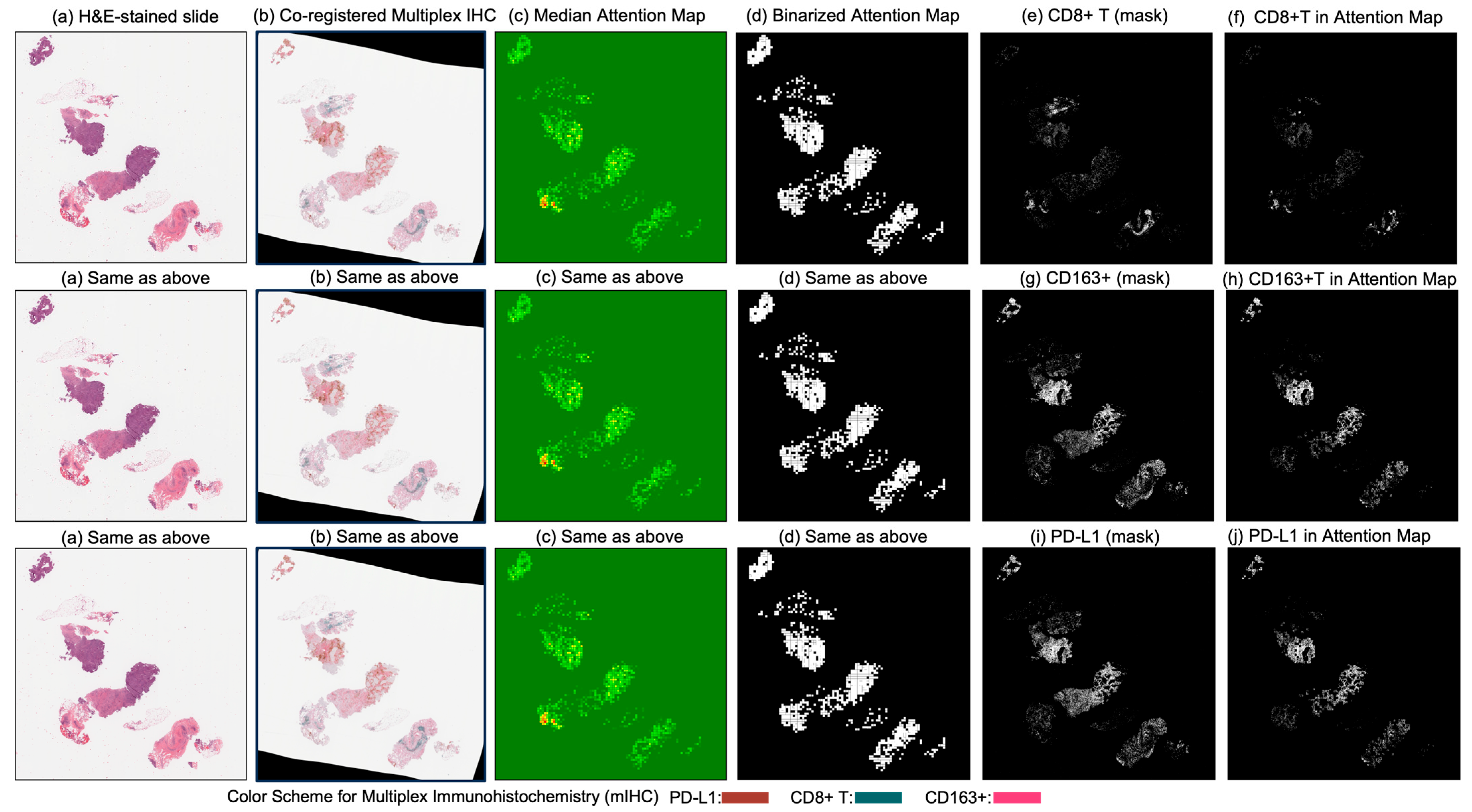 Cancers 17 02423 g006