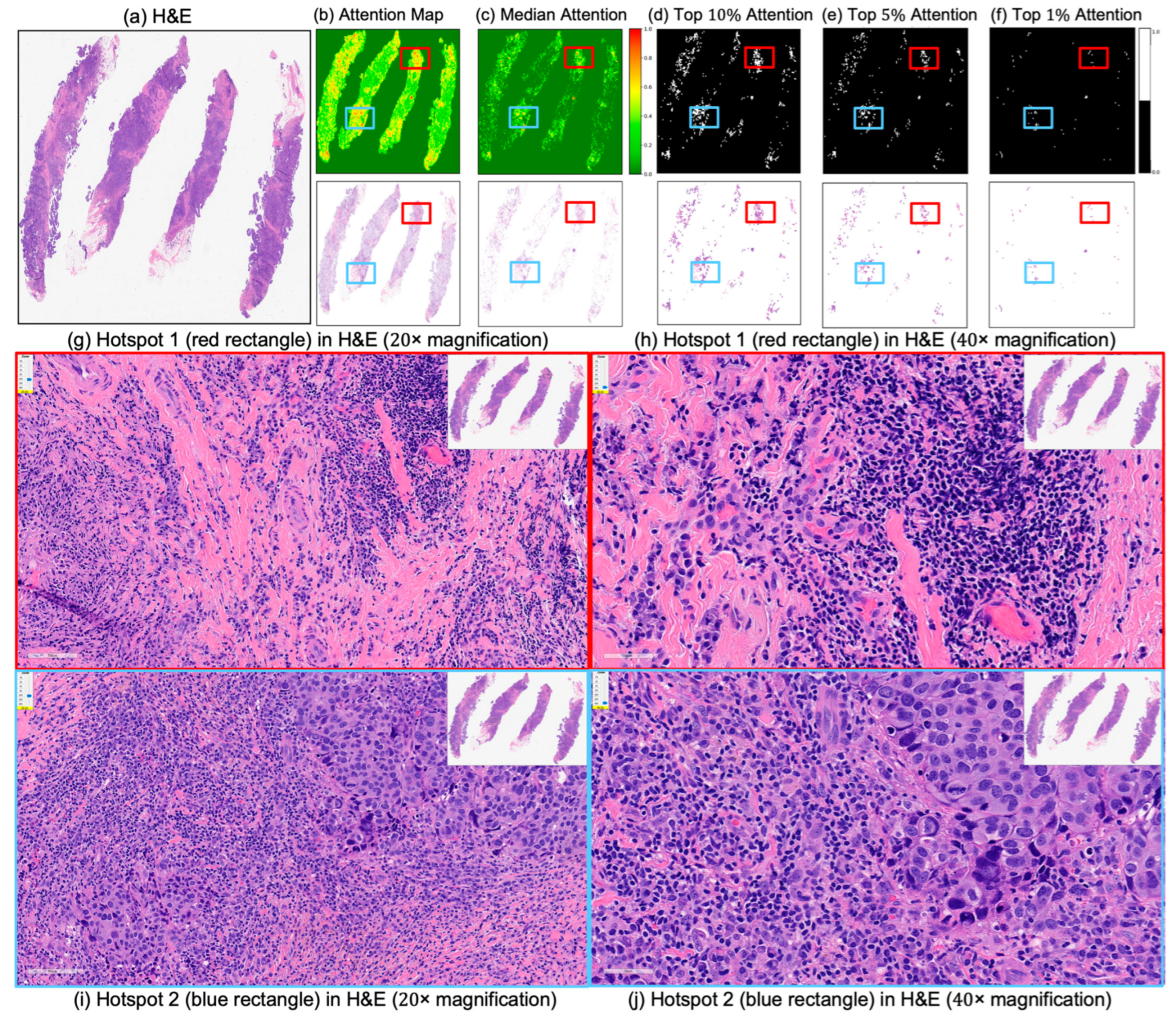 Cancers 17 02423 g007