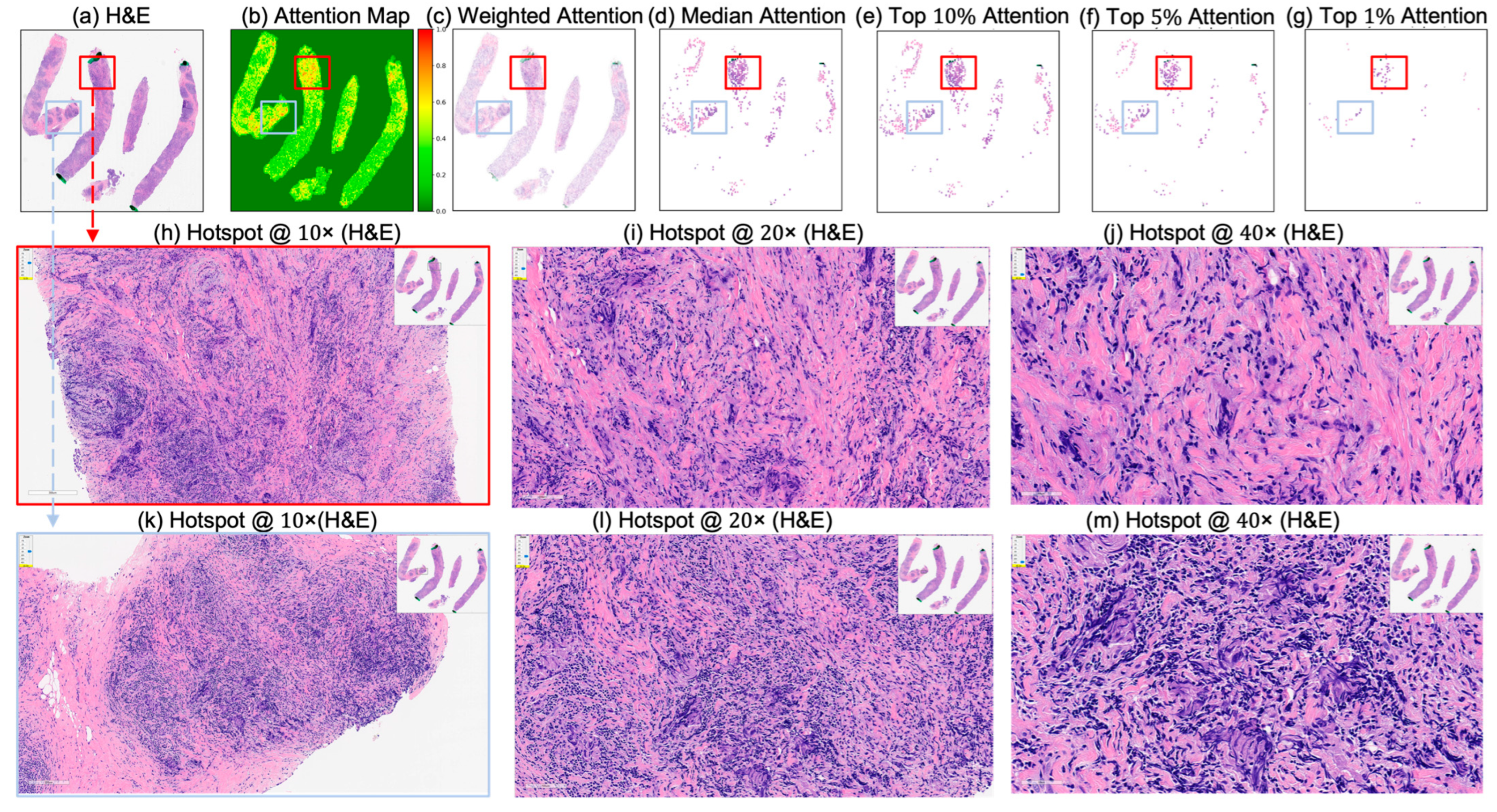 Cancers 17 02423 g009