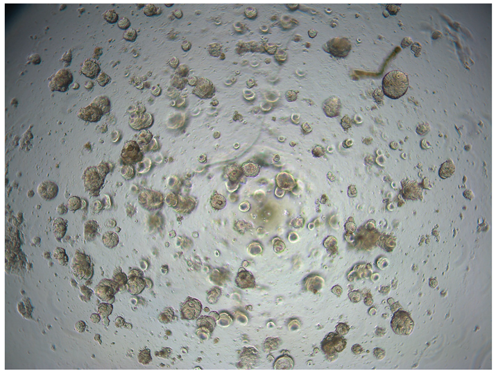 Cancers 17 02449 i001