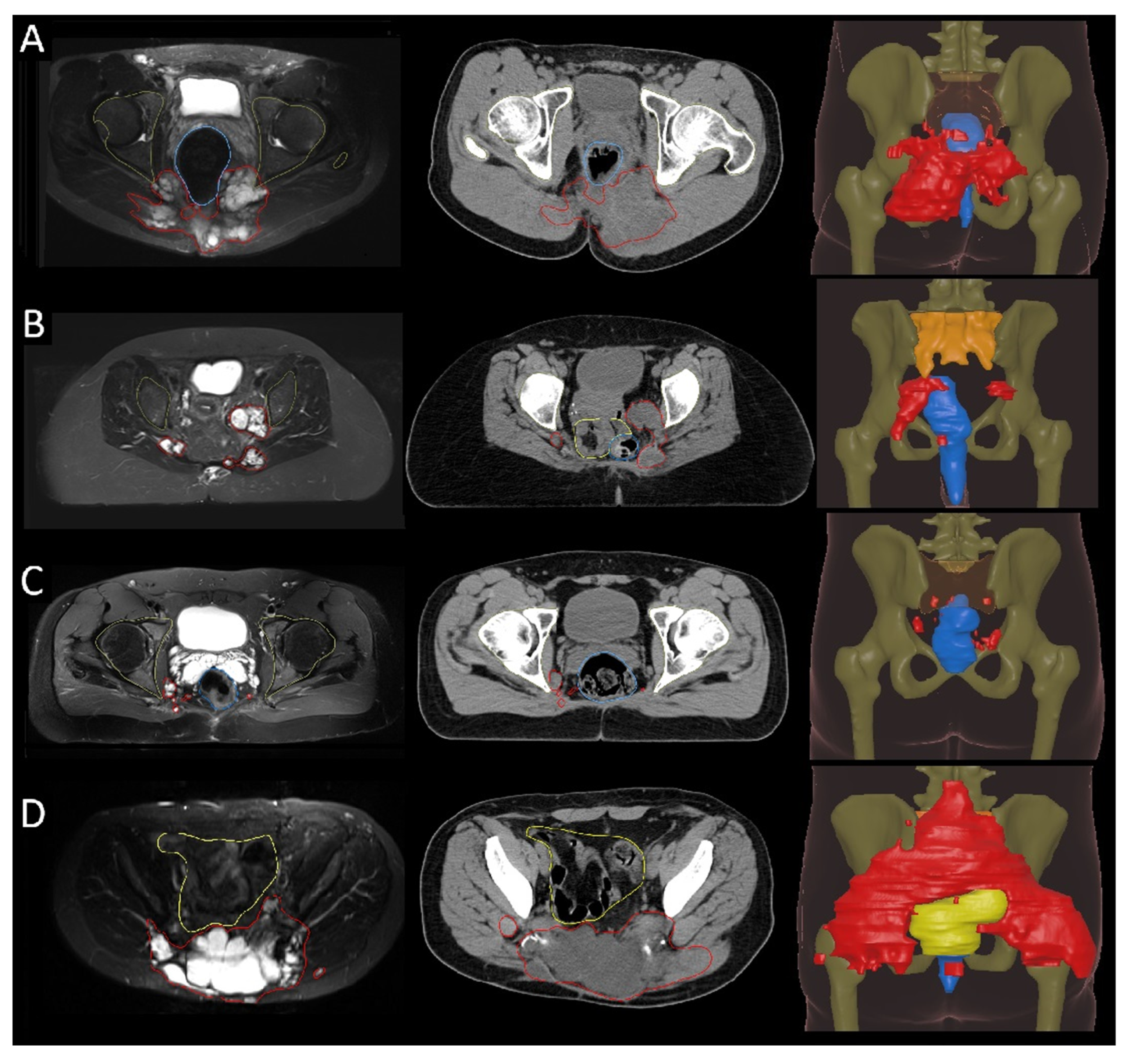 Cancers 17 02521 g001