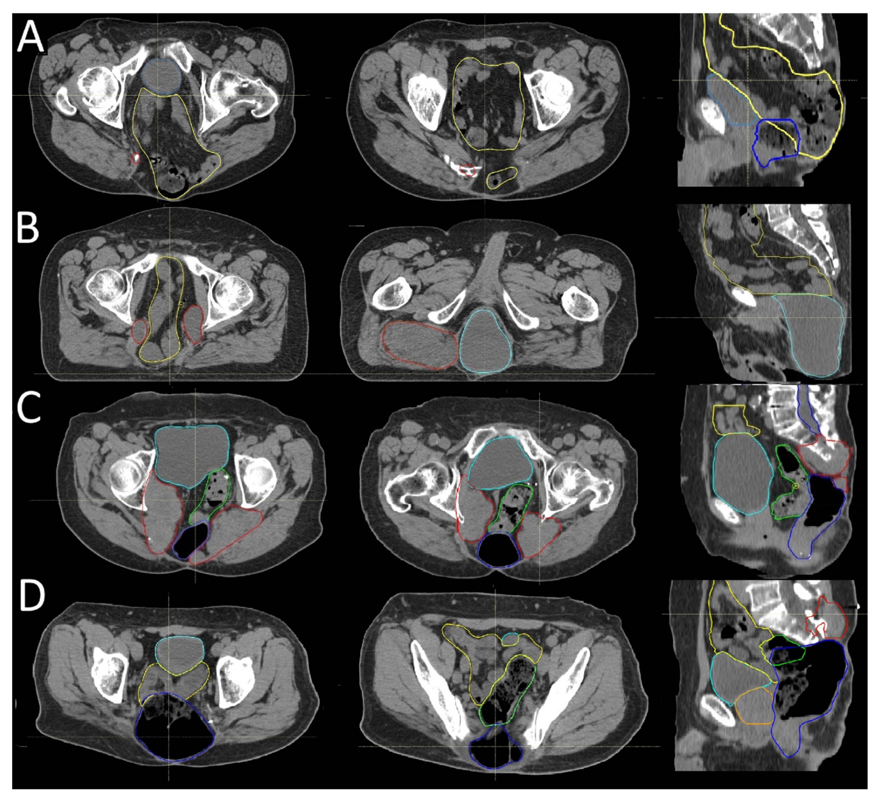 Cancers 17 02521 g002