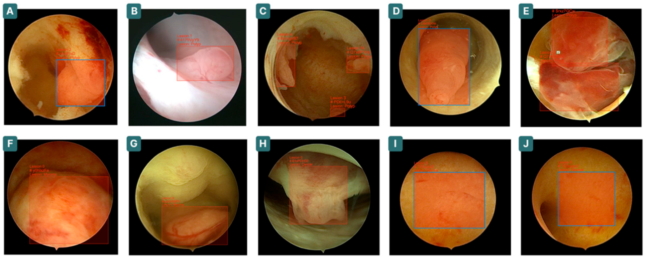 Cancers 17 02559 g001
