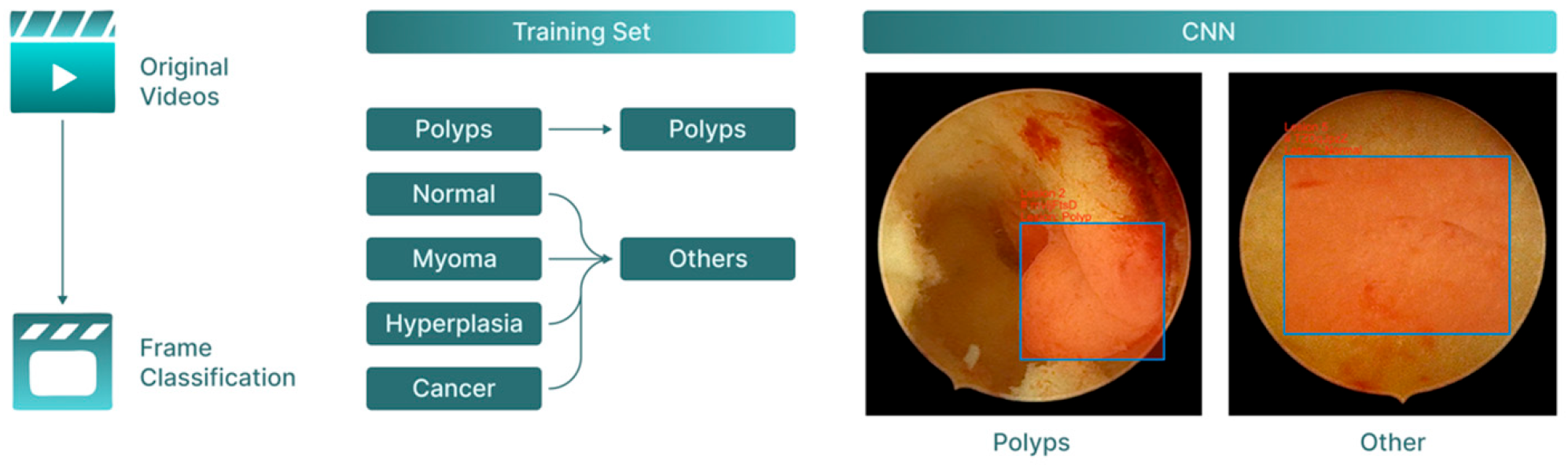 Cancers 17 02559 g002