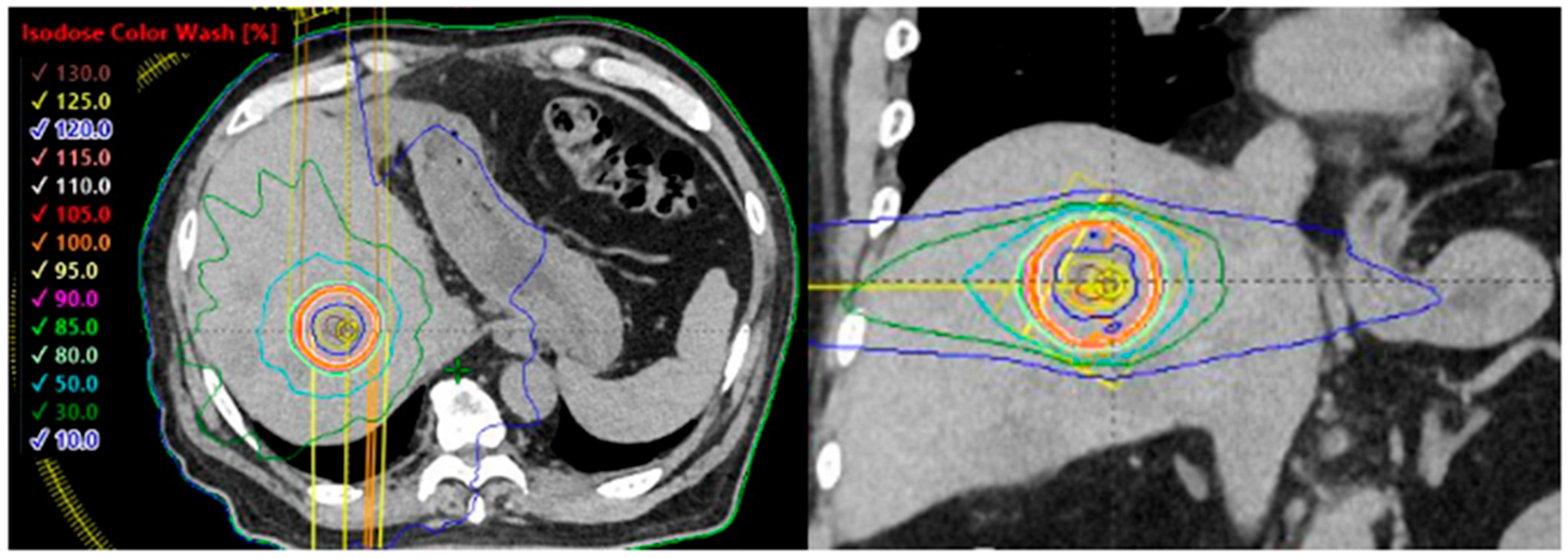 Cancers 17 02569 g001