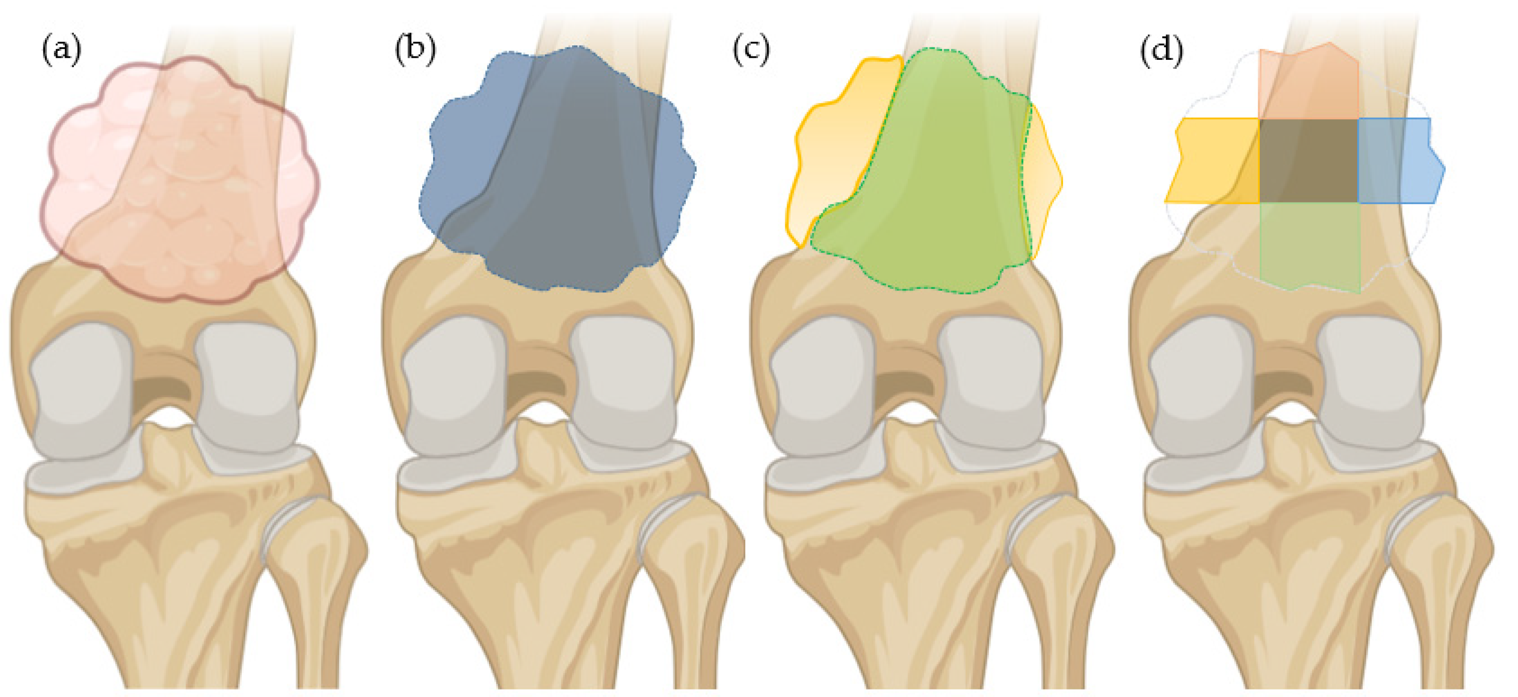 Cancers 17 02586 g003