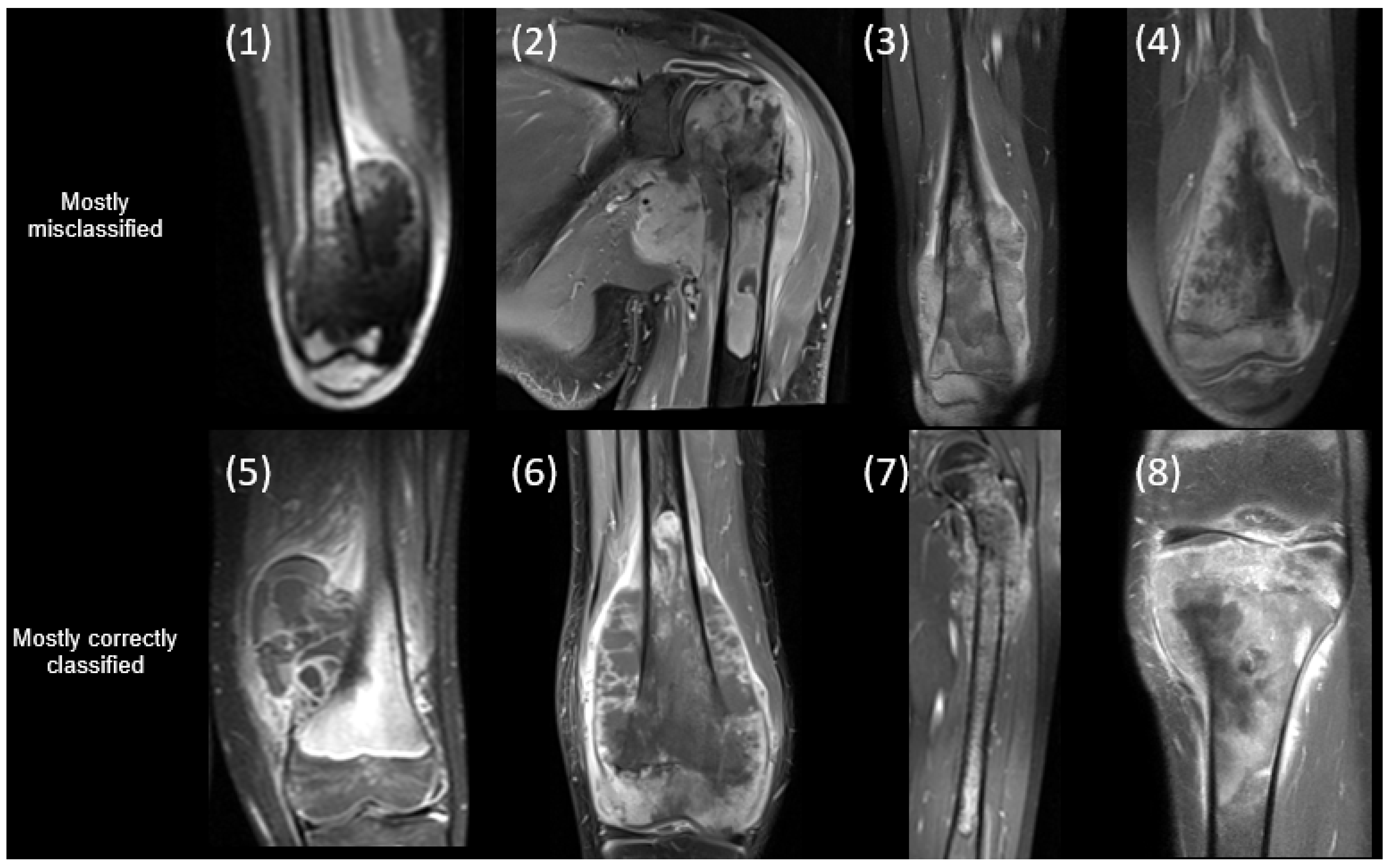 Cancers 17 02586 g004