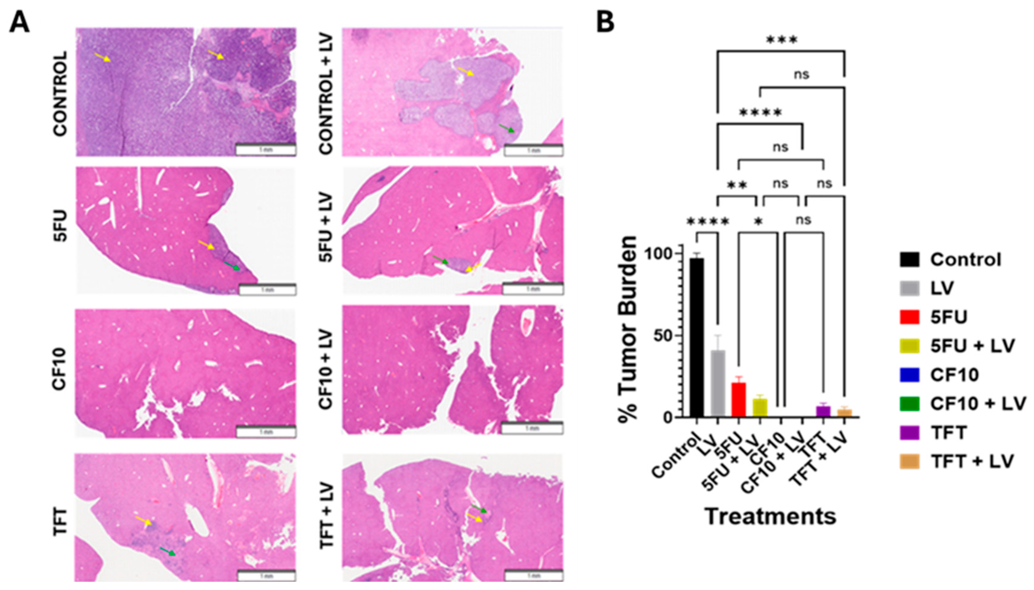 Cancers 17 02739 g005