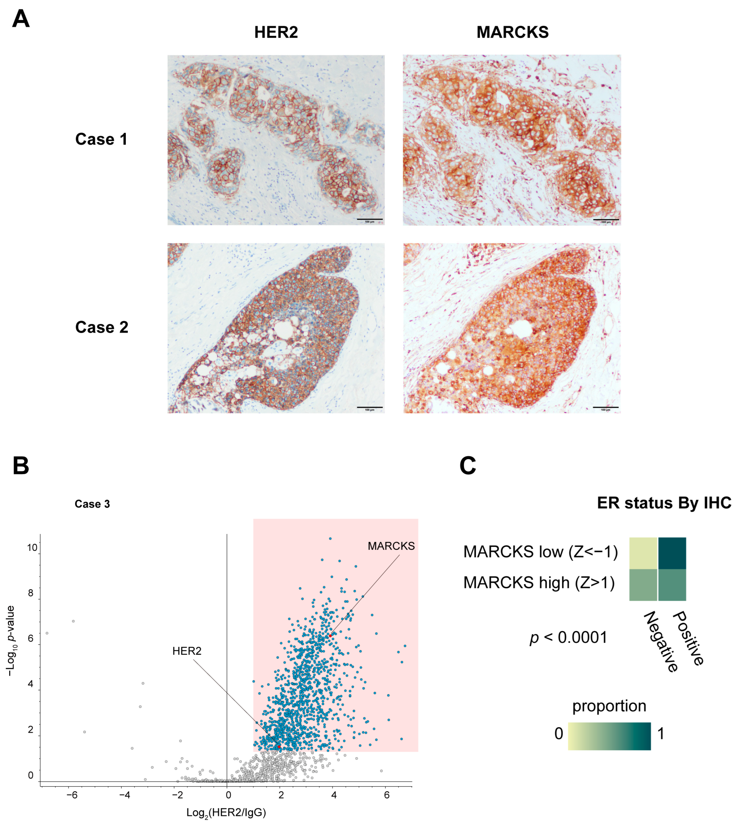 Cancers 17 02882 g005 Cancers 17 02882 g005