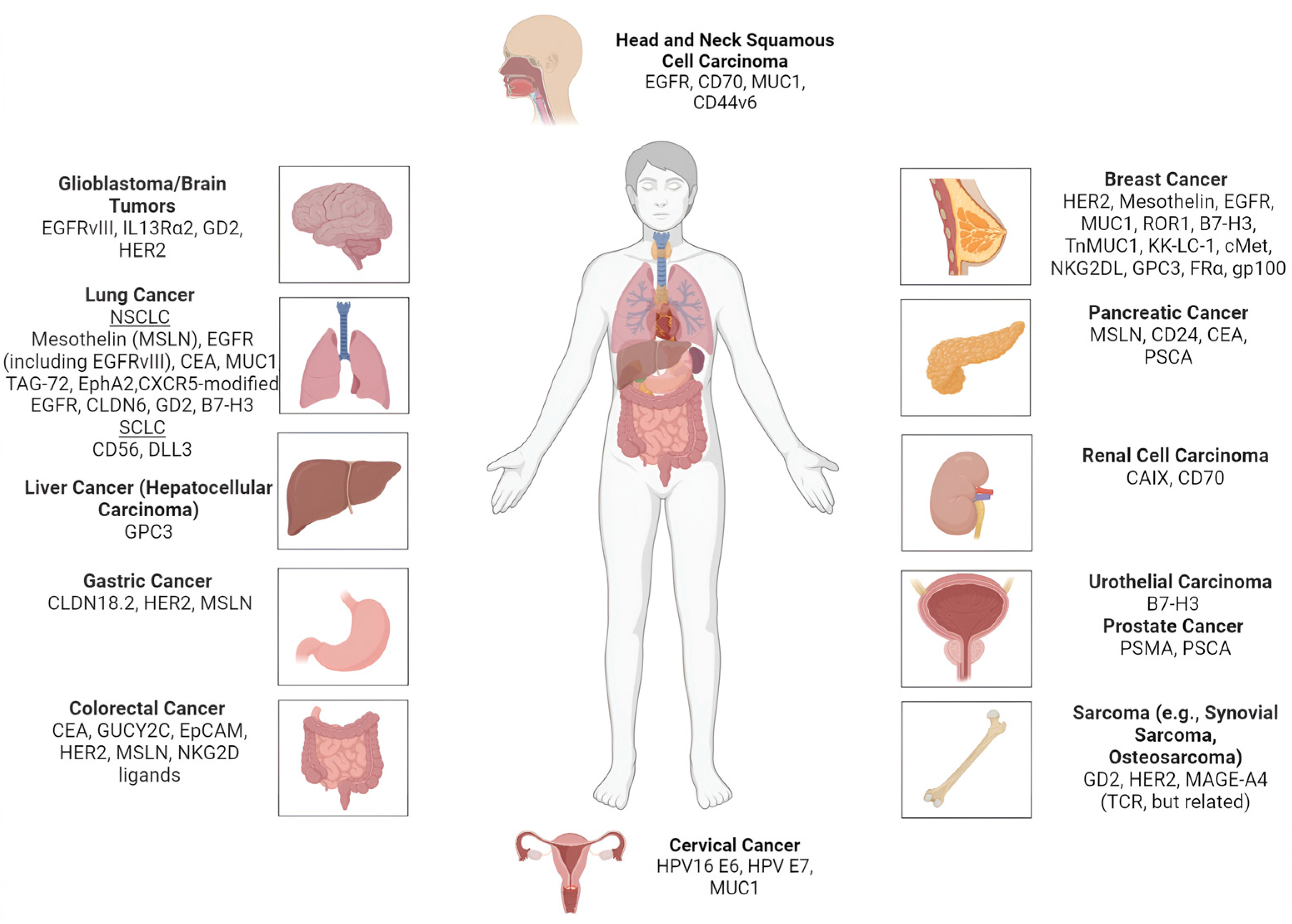 Cancers 17 02898 g002