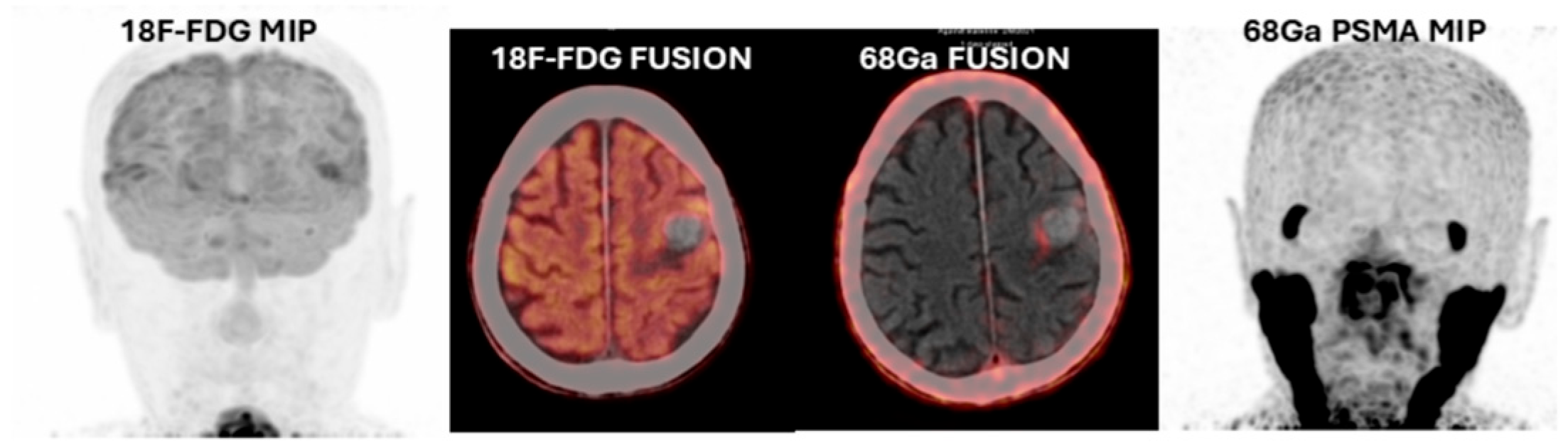 Cancers 17 03088 g003