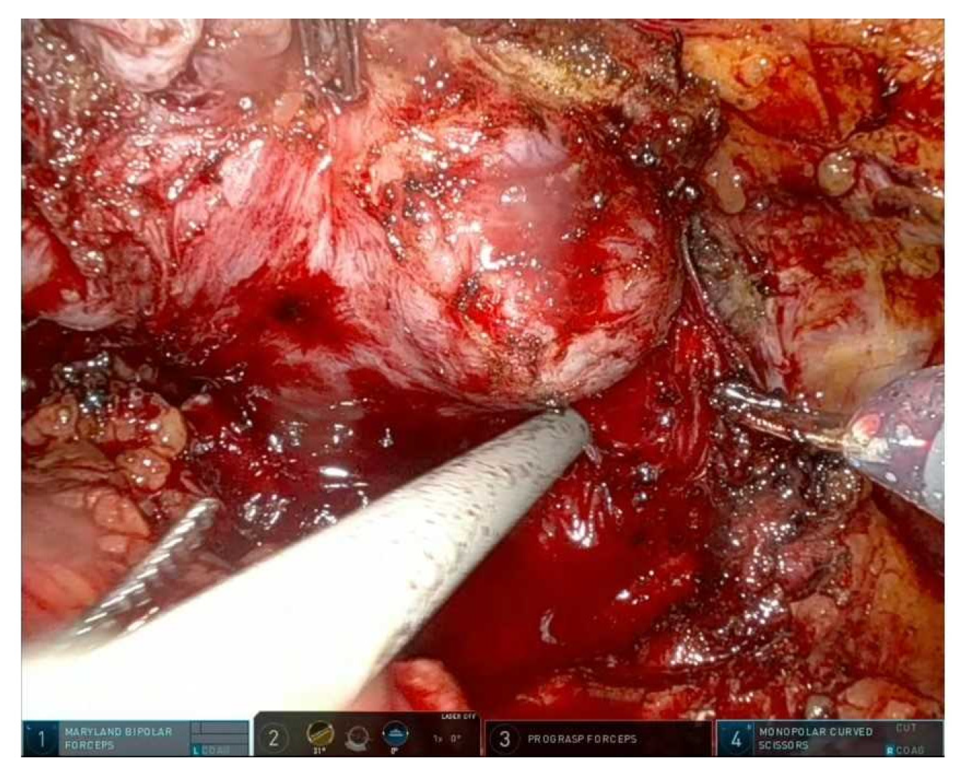 Cancers 17 03122 g002 Cancers 17 03122 g002