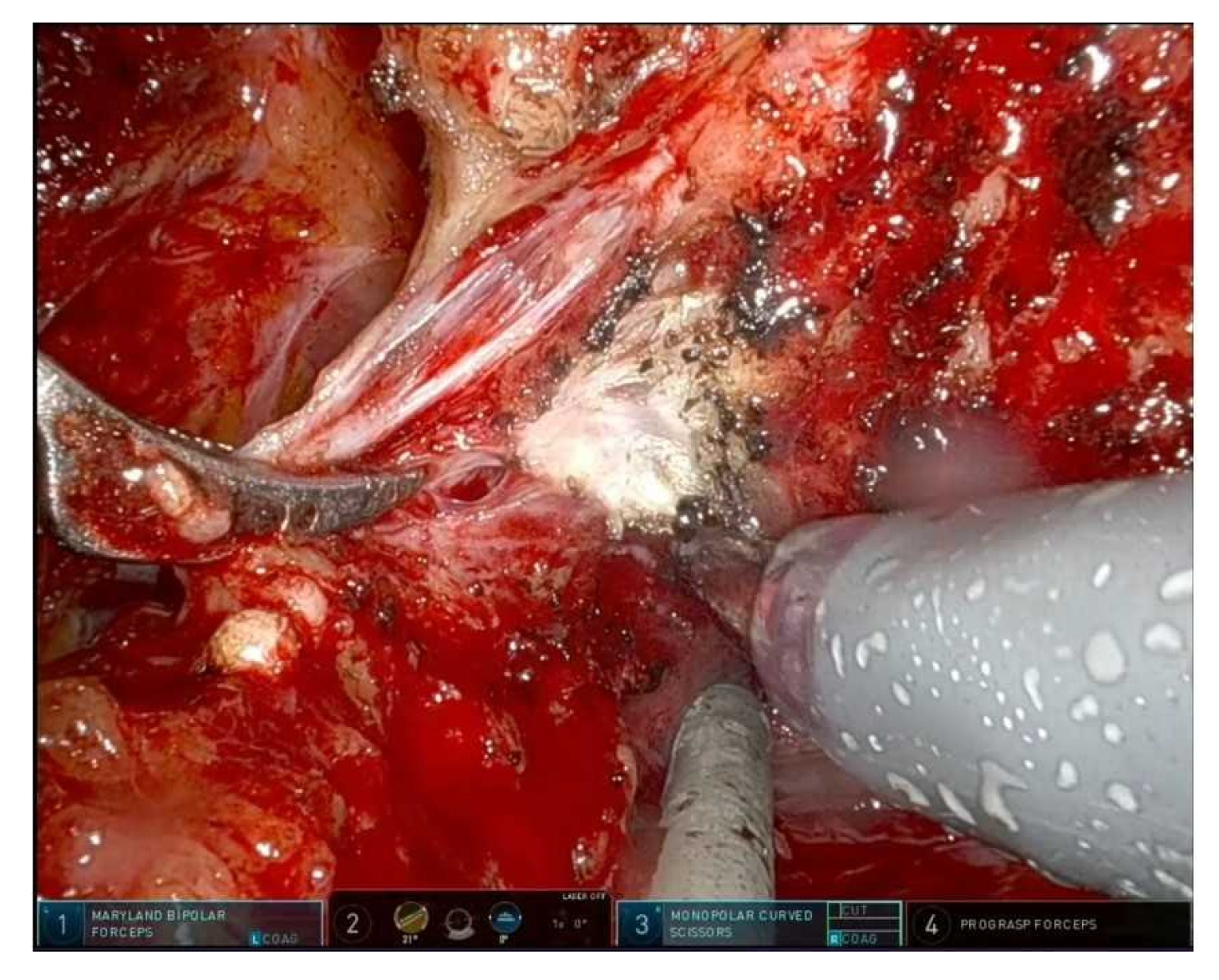 Cancers 17 03122 g003 Cancers 17 03122 g003