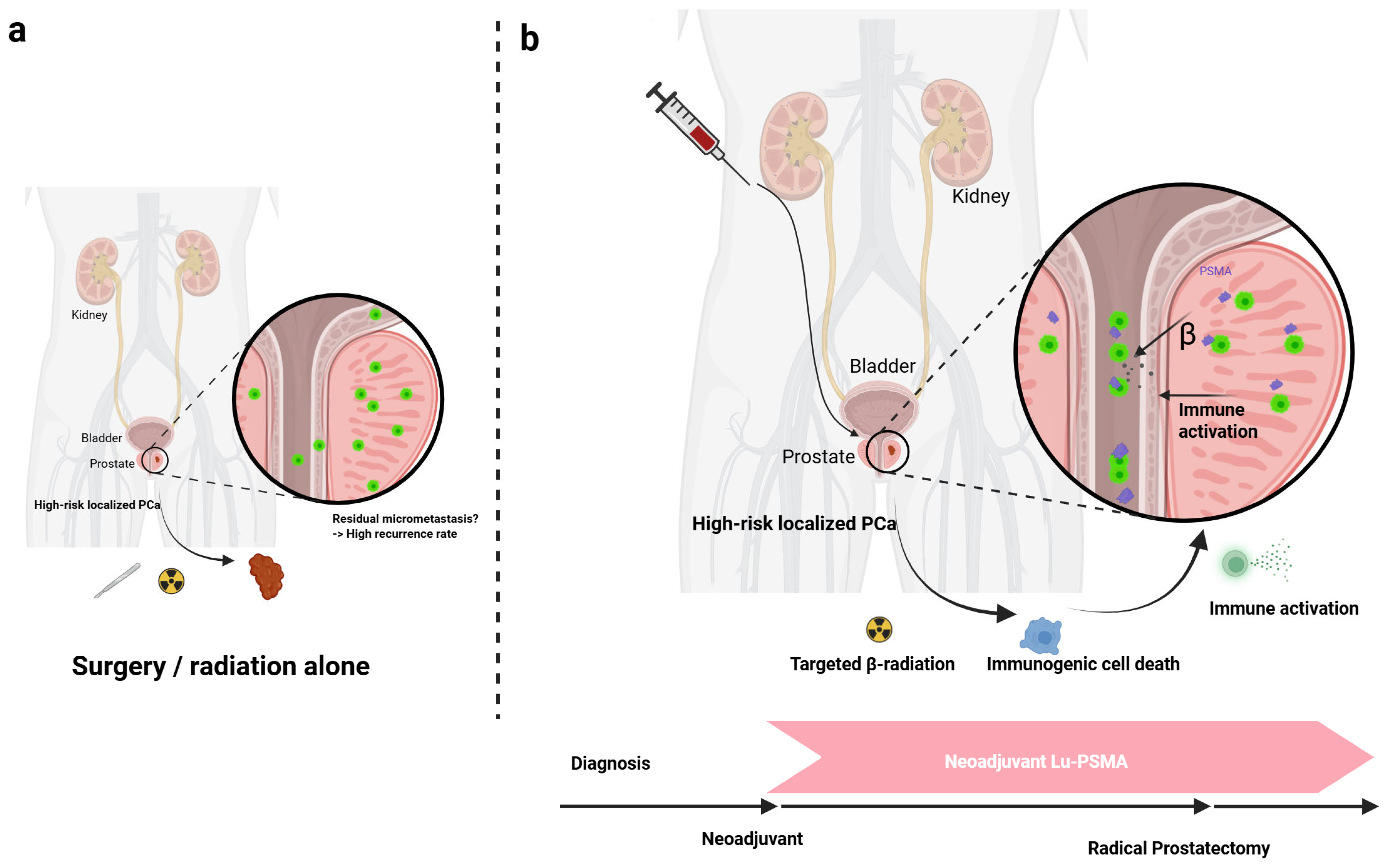 Cancers 17 03330 g001