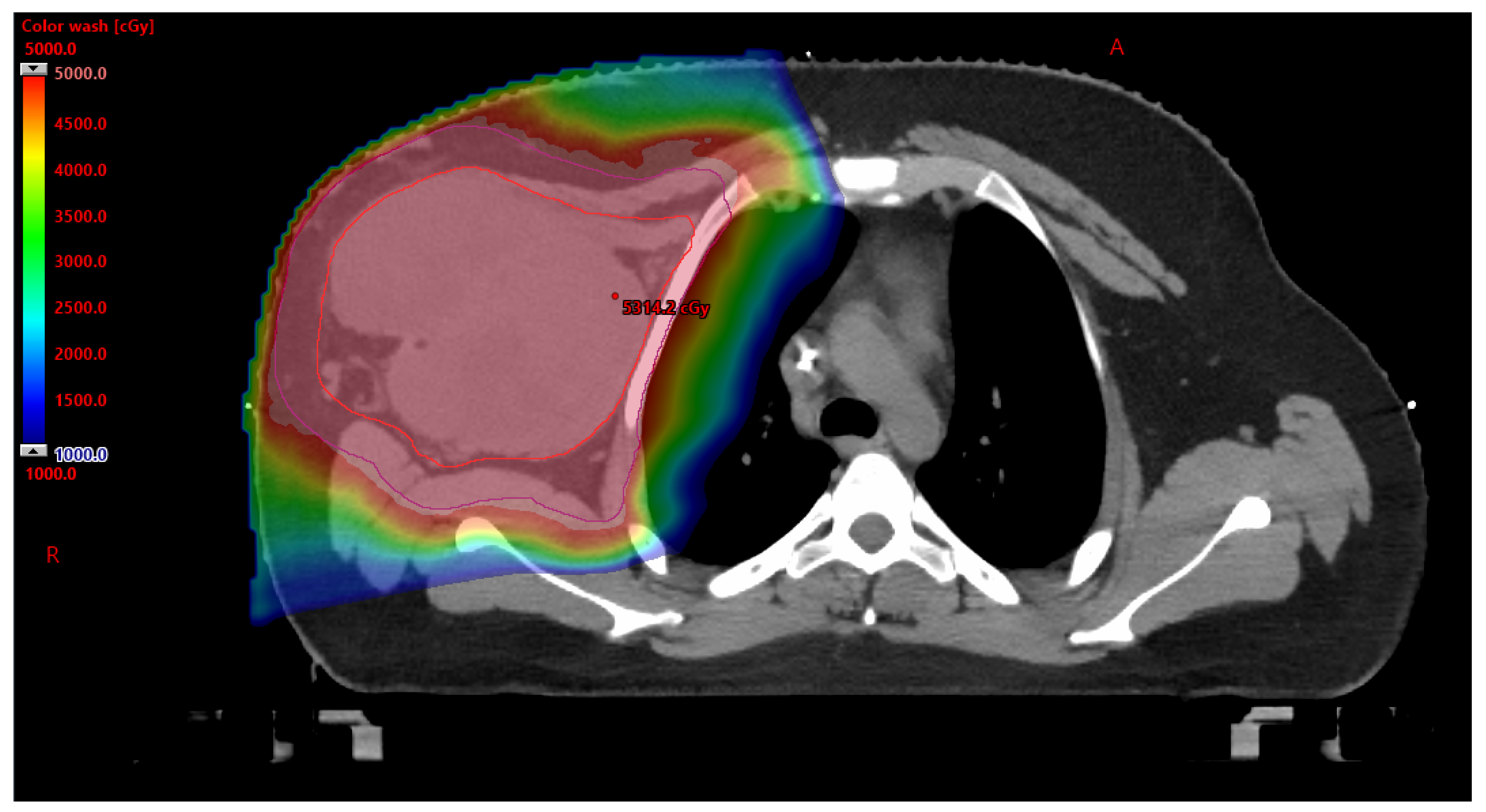 Cancers 17 03402 g001