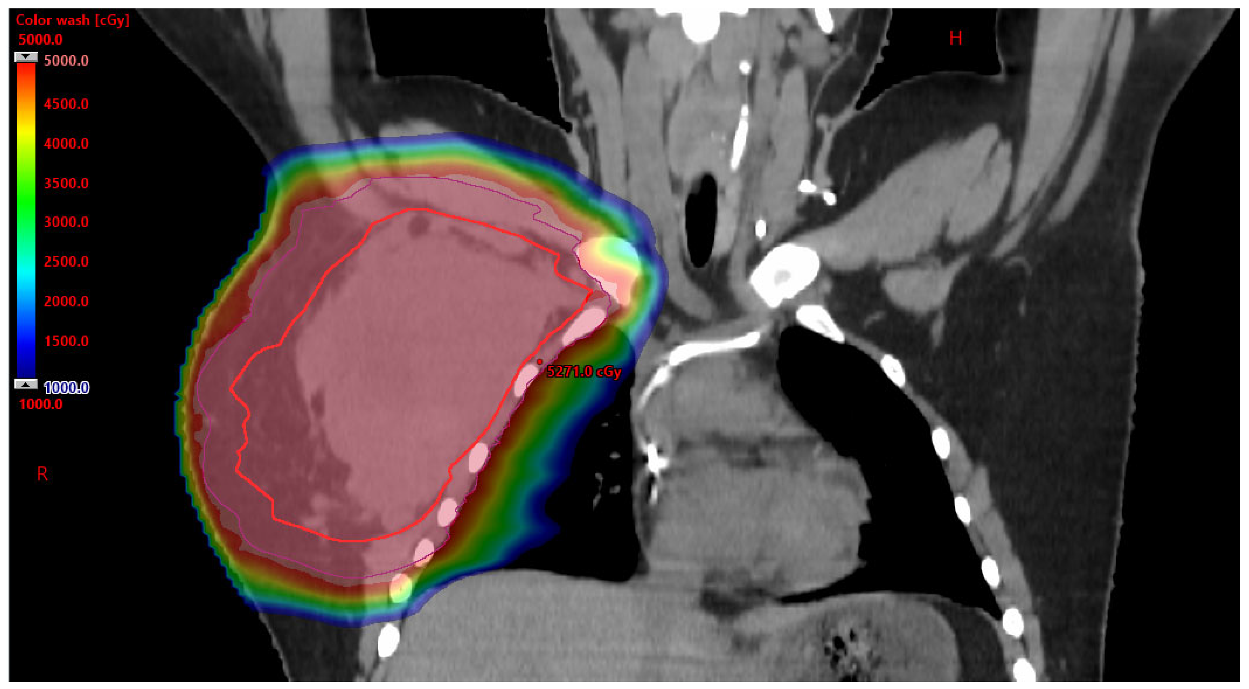 Cancers 17 03402 g002