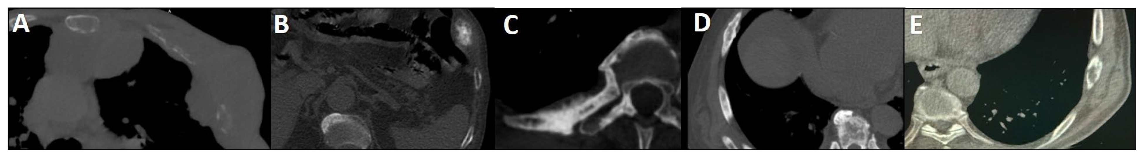 Cancers 17 03404 g001