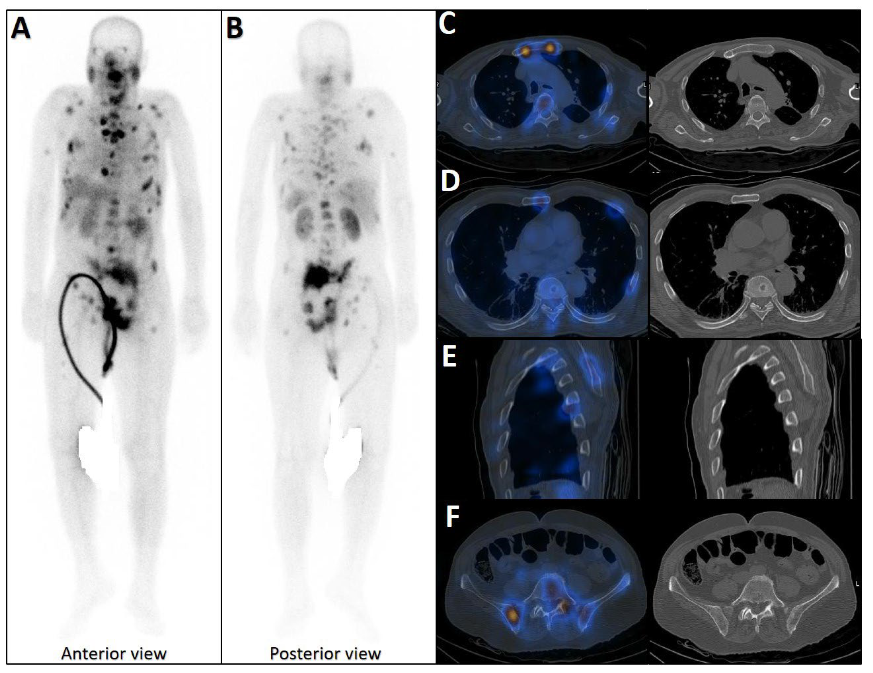 Cancers 17 03404 g002