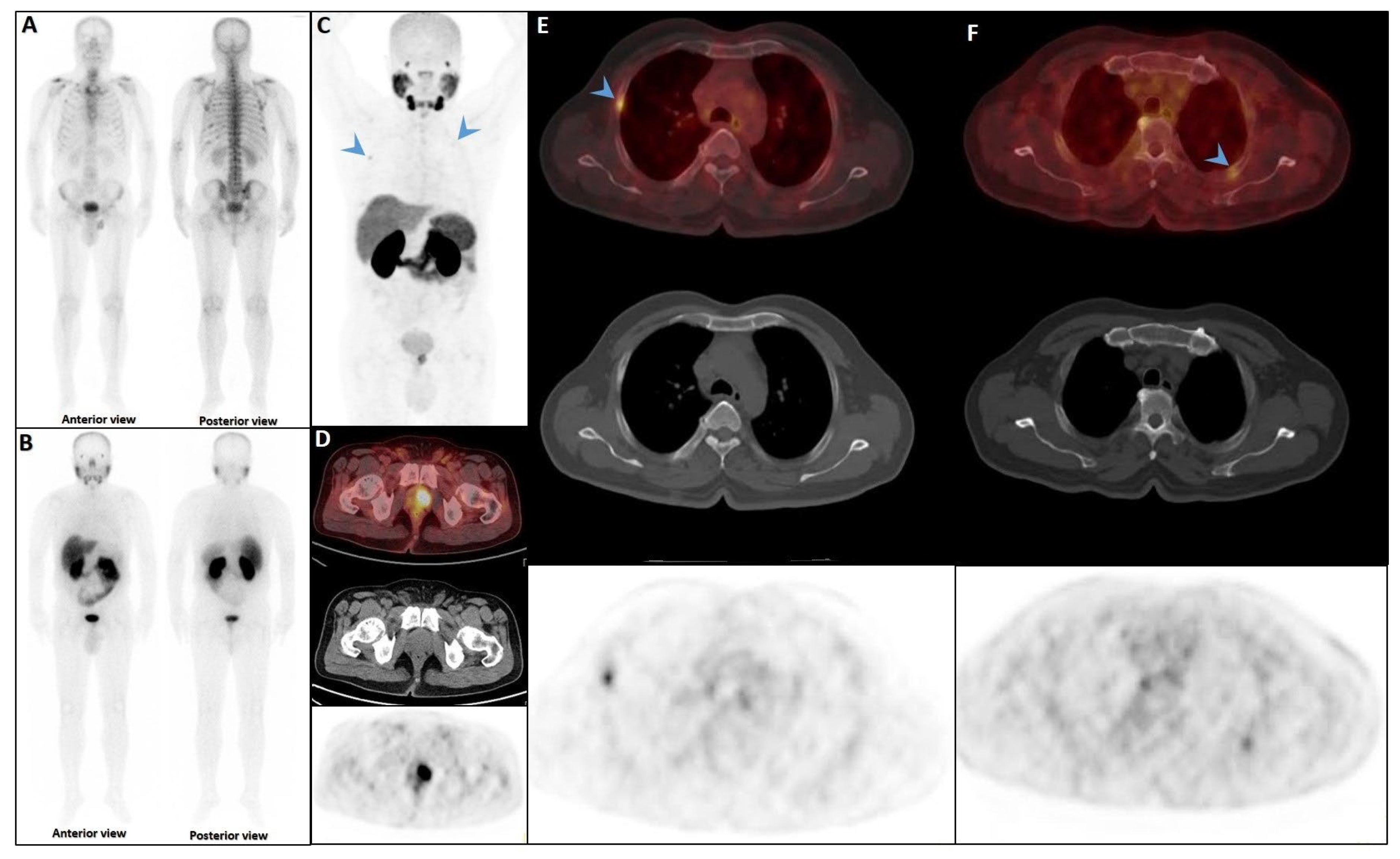 Cancers 17 03404 g006