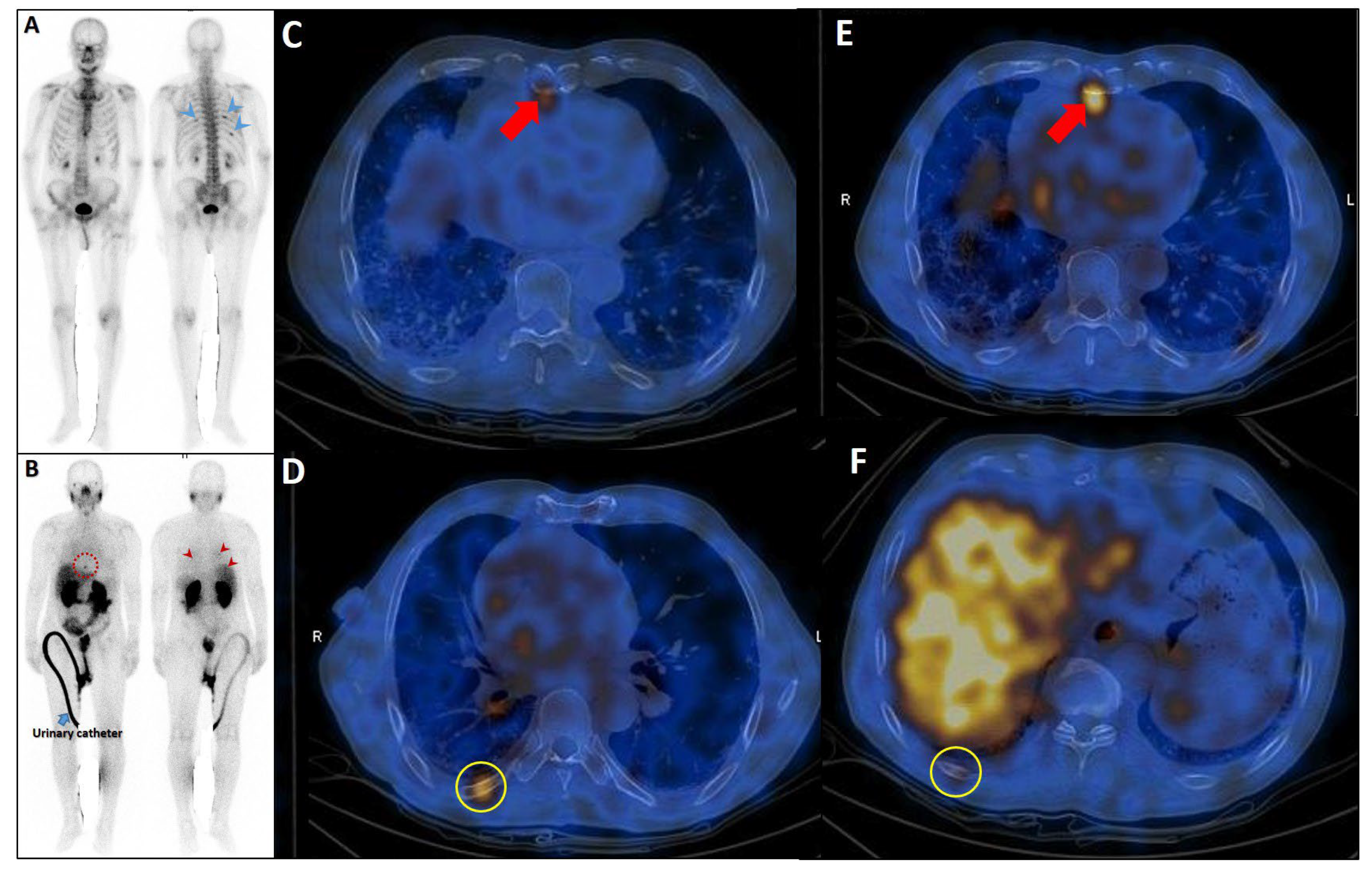 Cancers 17 03404 g008