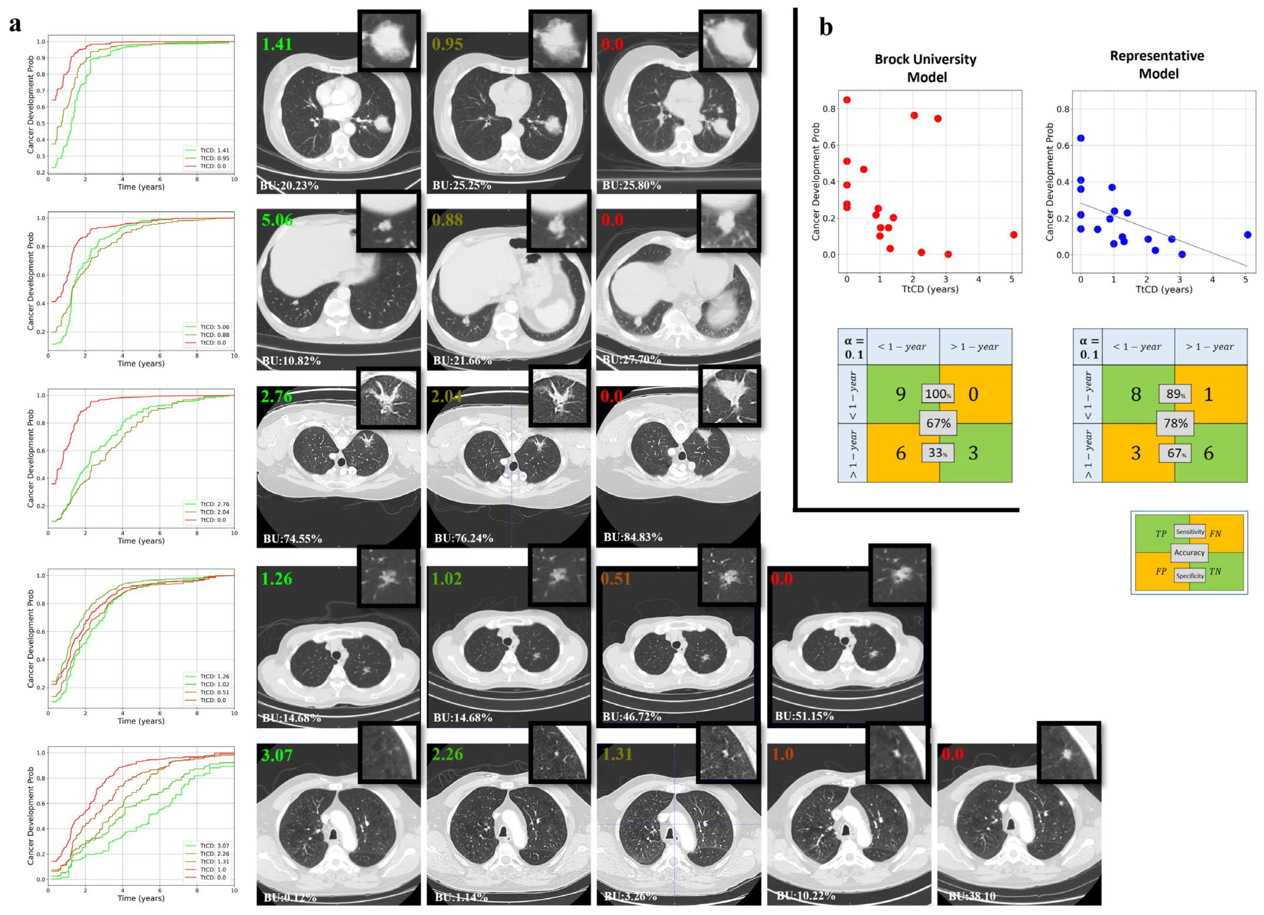 Cancers 17 03406 g005 Cancers 17 03406 g005