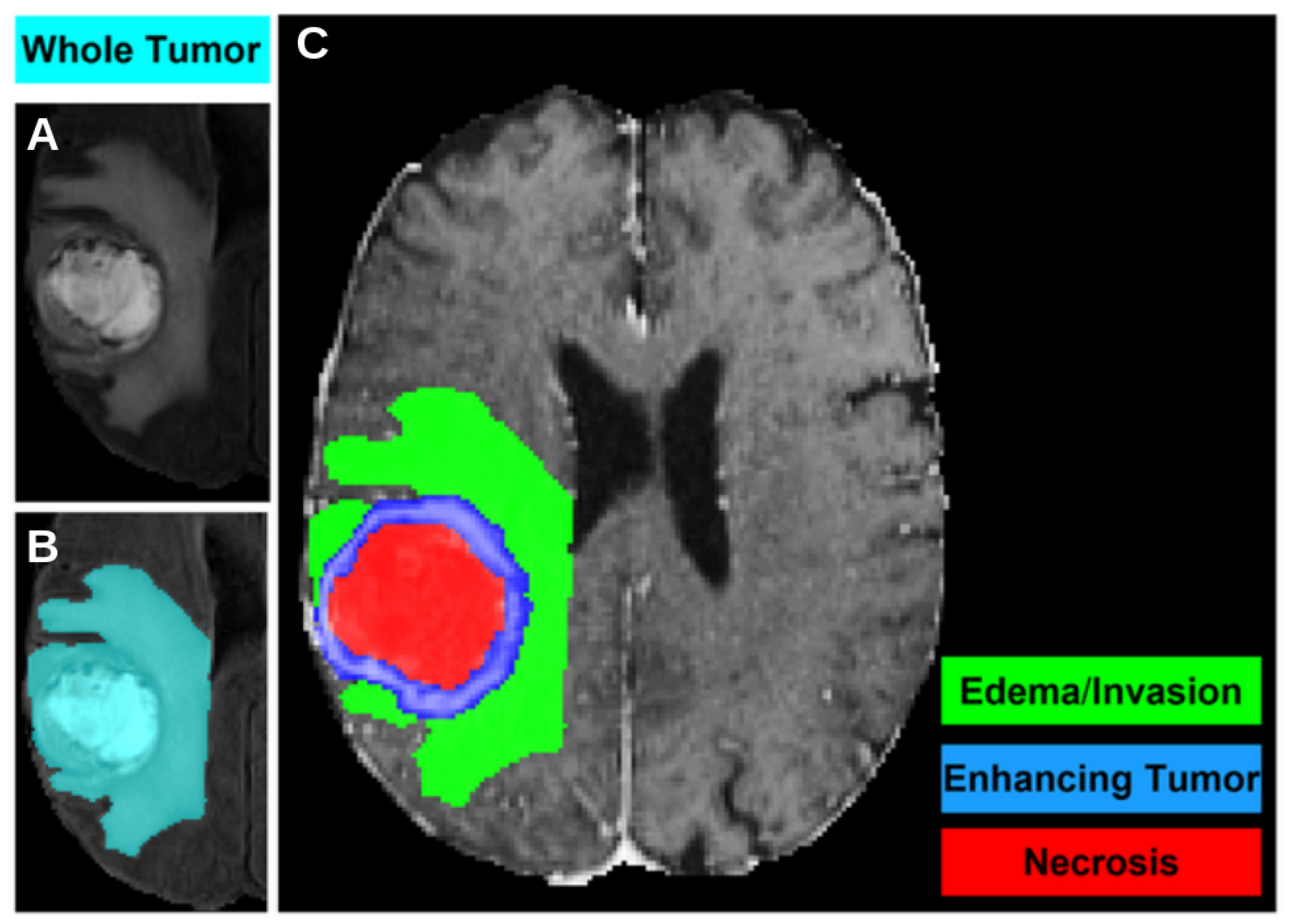 Cancers 17 03417 g001 Cancers 17 03417 g001