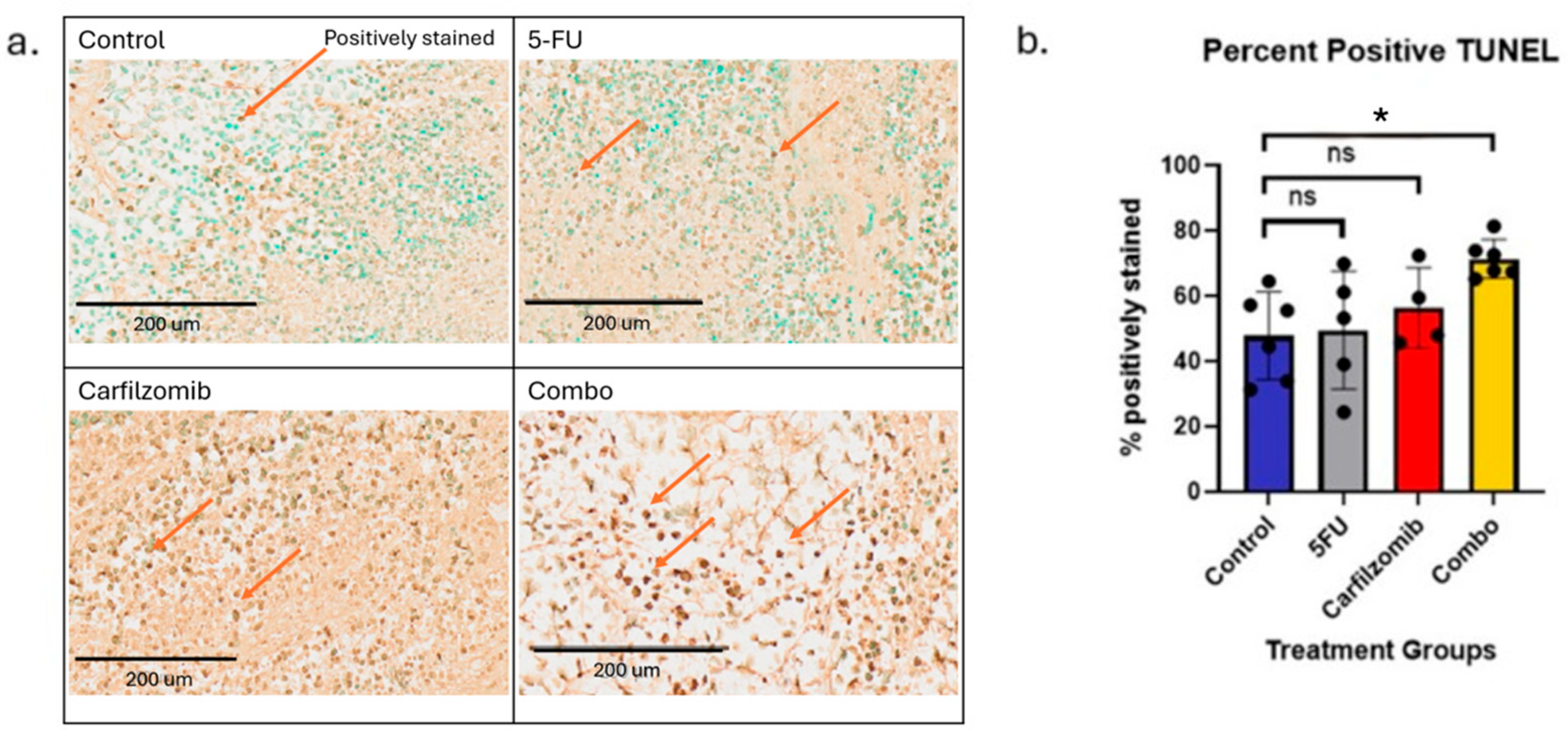 Cancers 17 03420 g008 Cancers 17 03420 g008