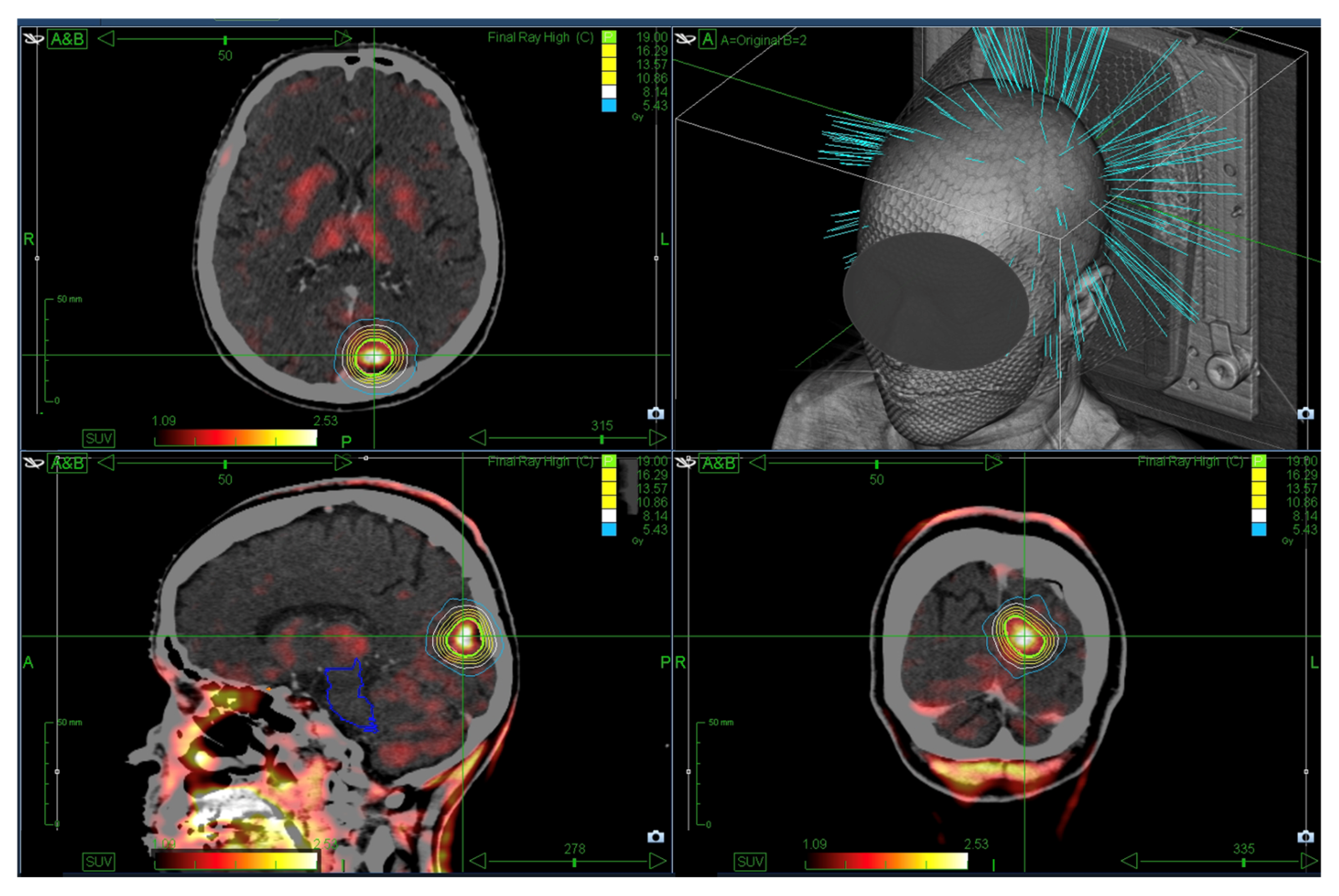 Cancers 17 03423 g001