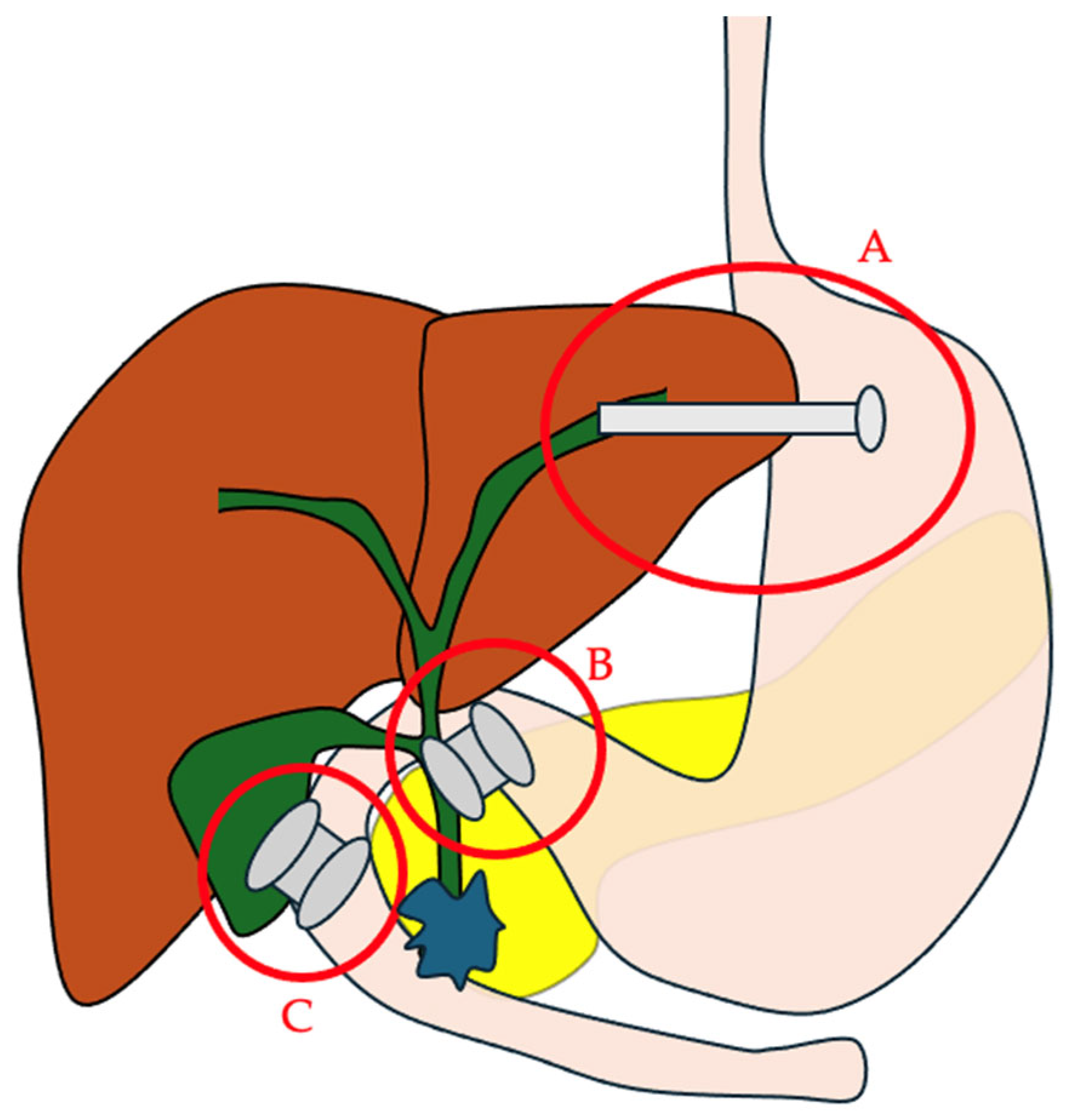 Cancers 17 03428 g001 Cancers 17 03428 g001