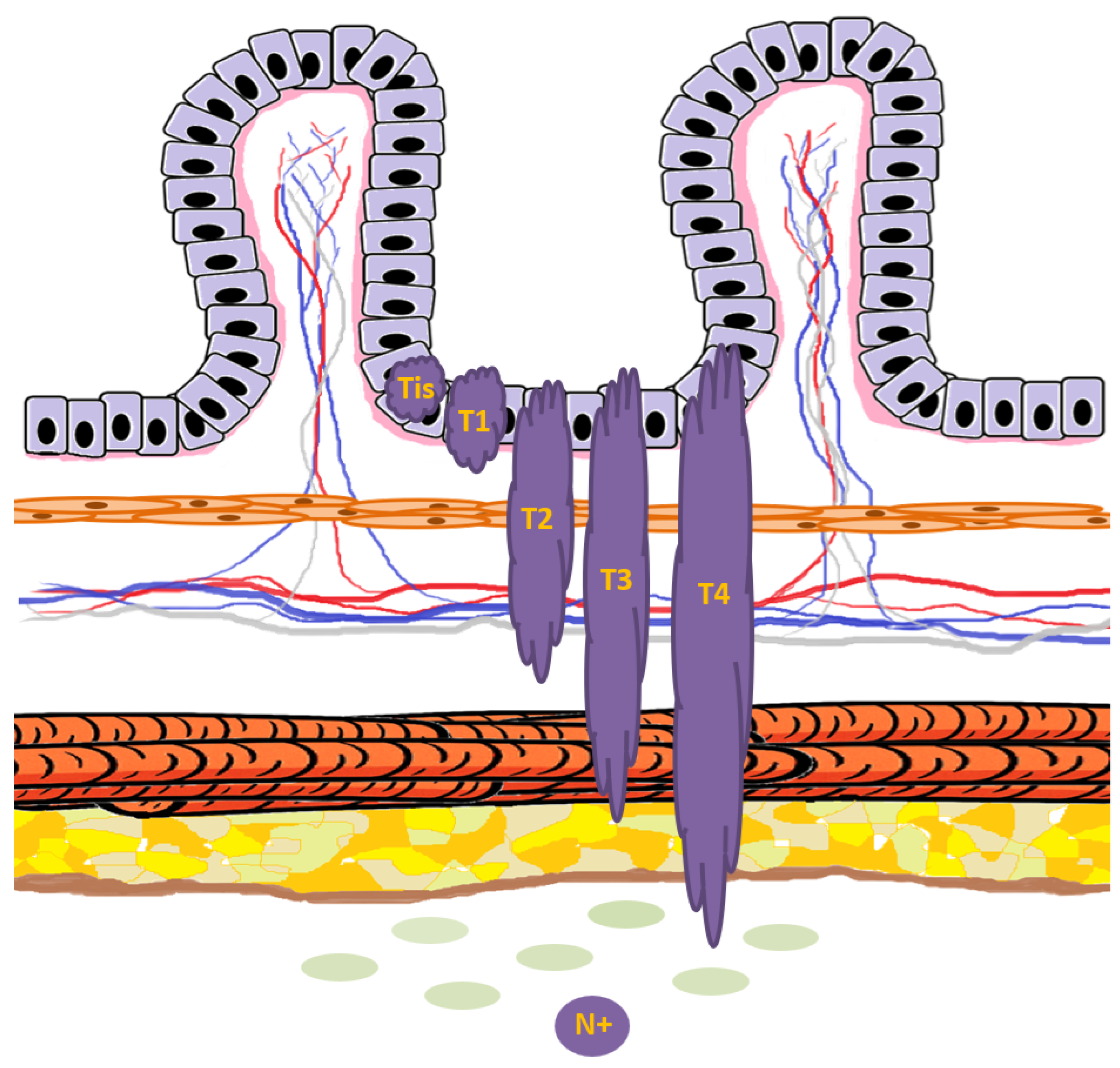 Cancers 17 03438 g007