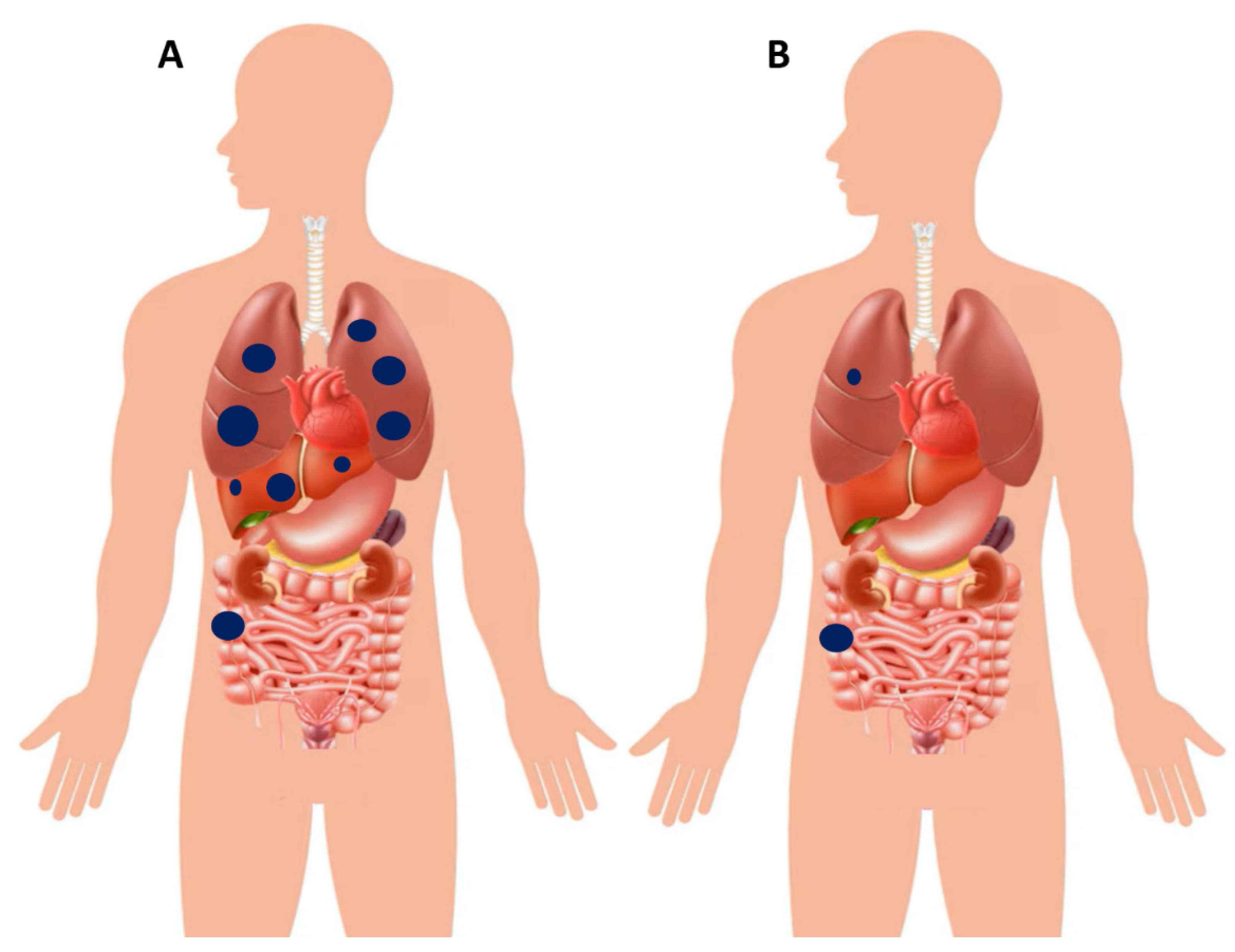 Cancers 17 03438 g008