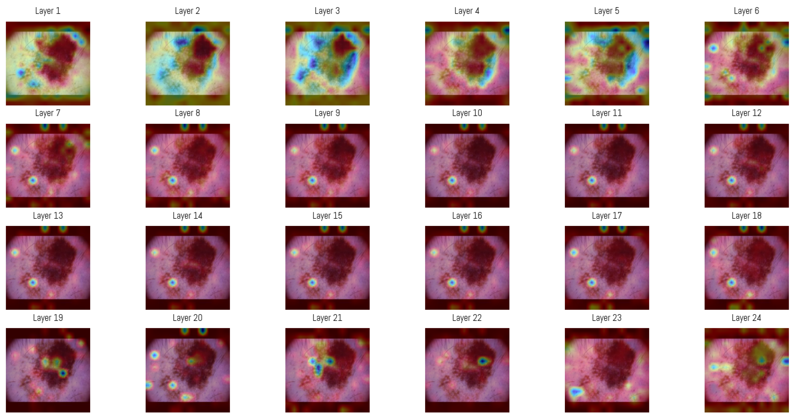 Cancers 17 03447 g006