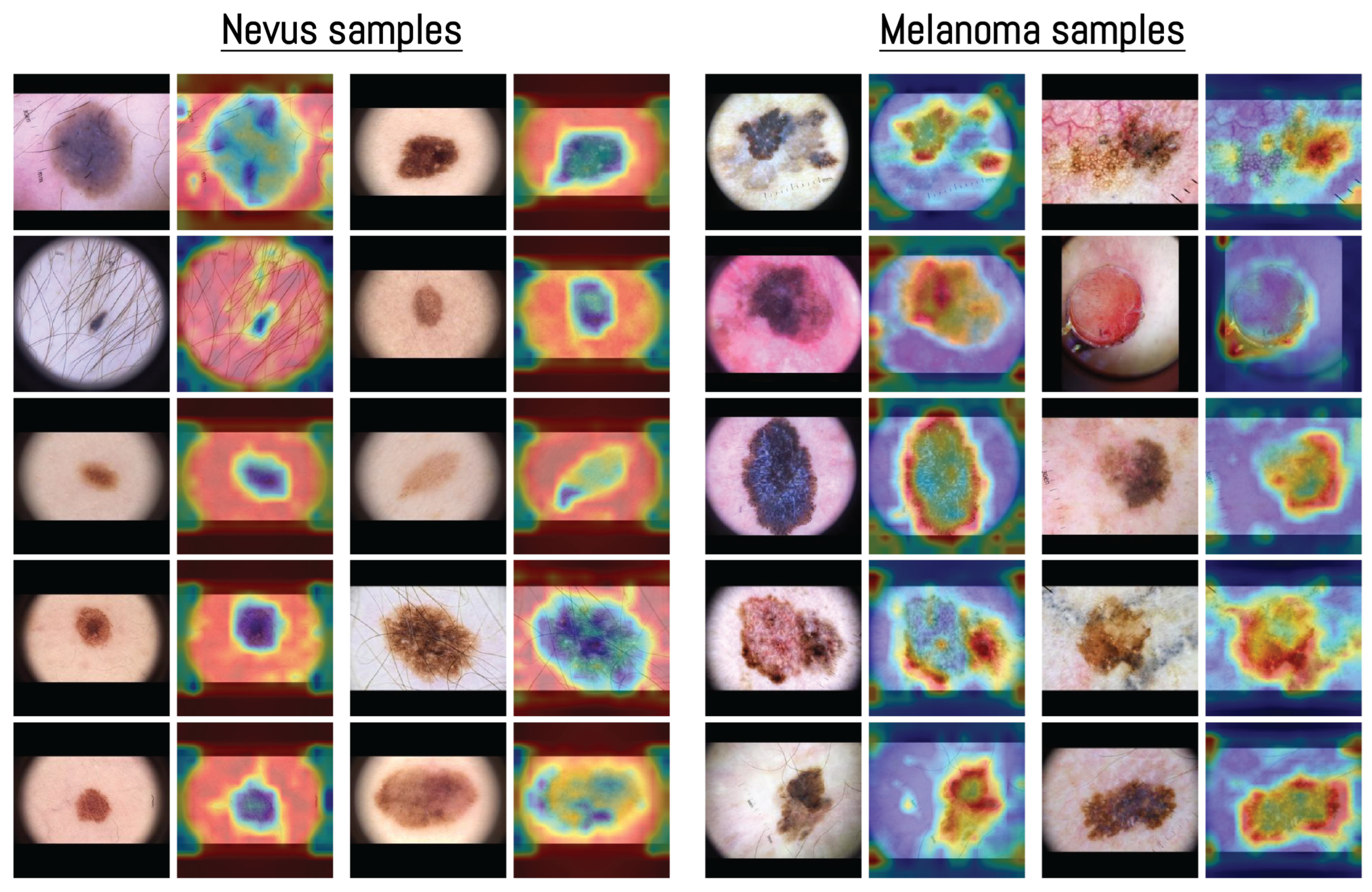 Cancers 17 03447 g007