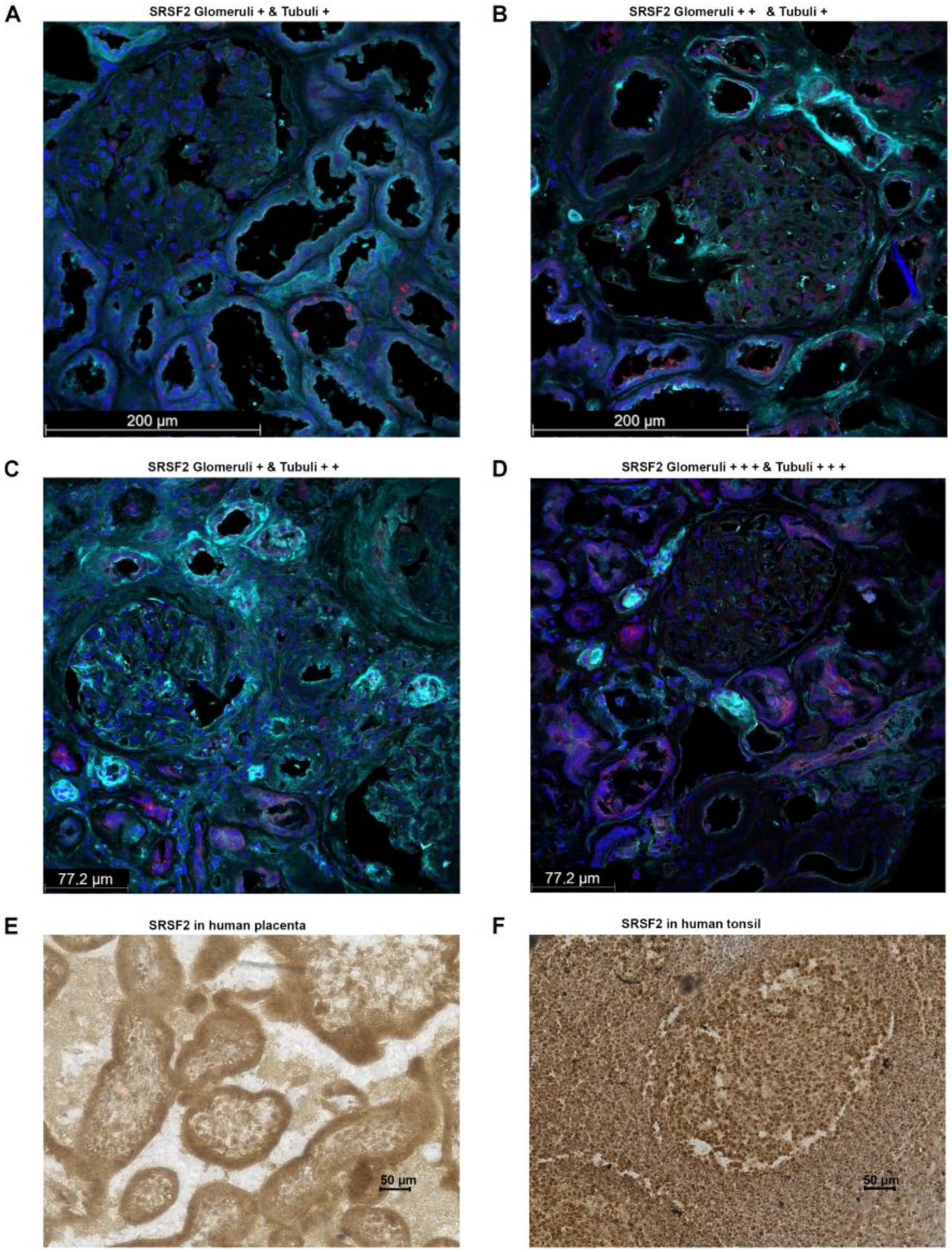 Cancers 17 03463 g004