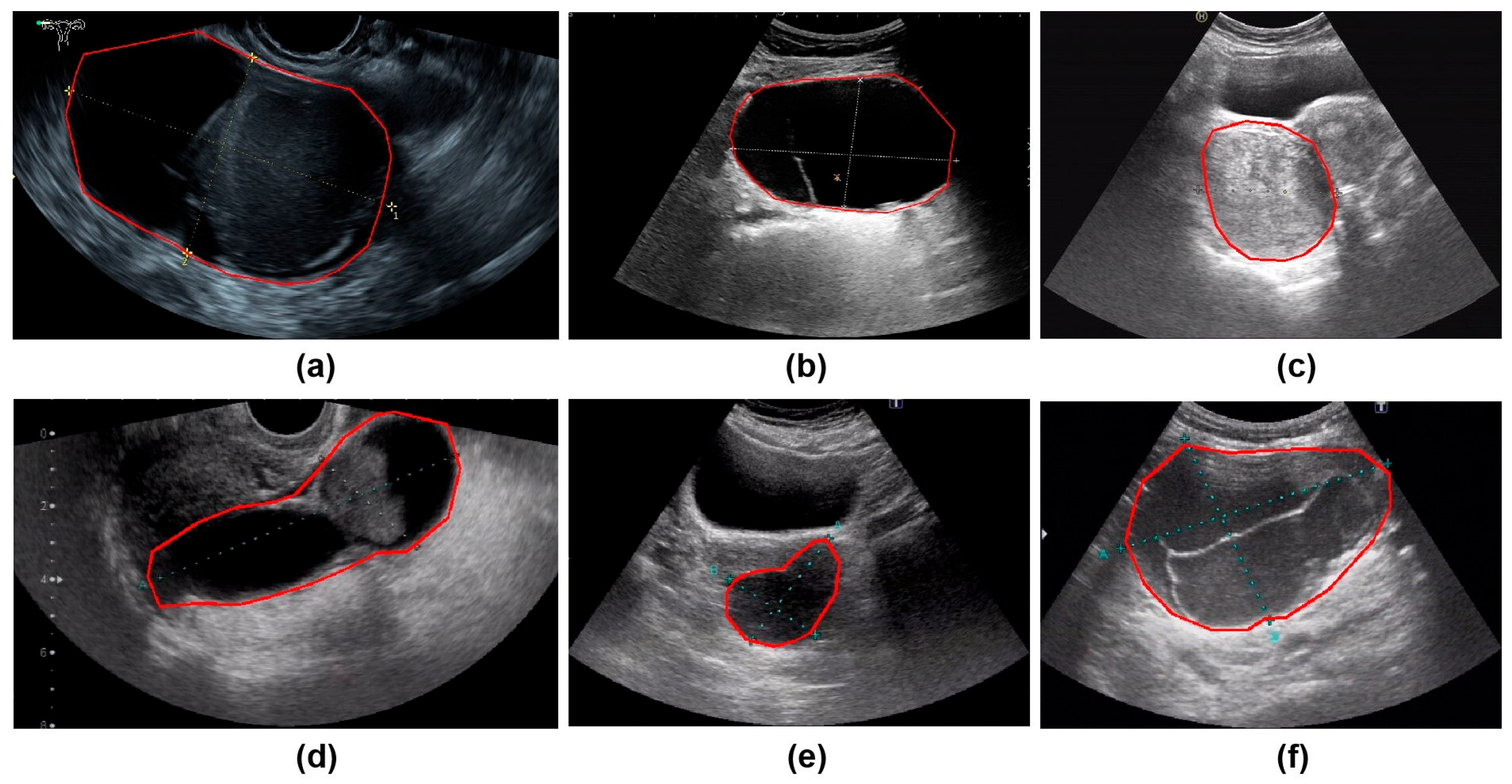 Cancers 17 03466 g002