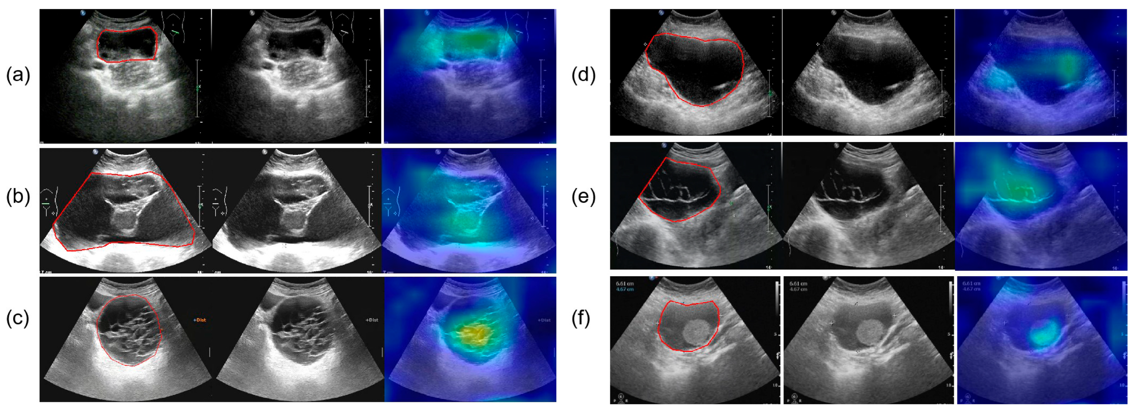 Cancers 17 03466 g010