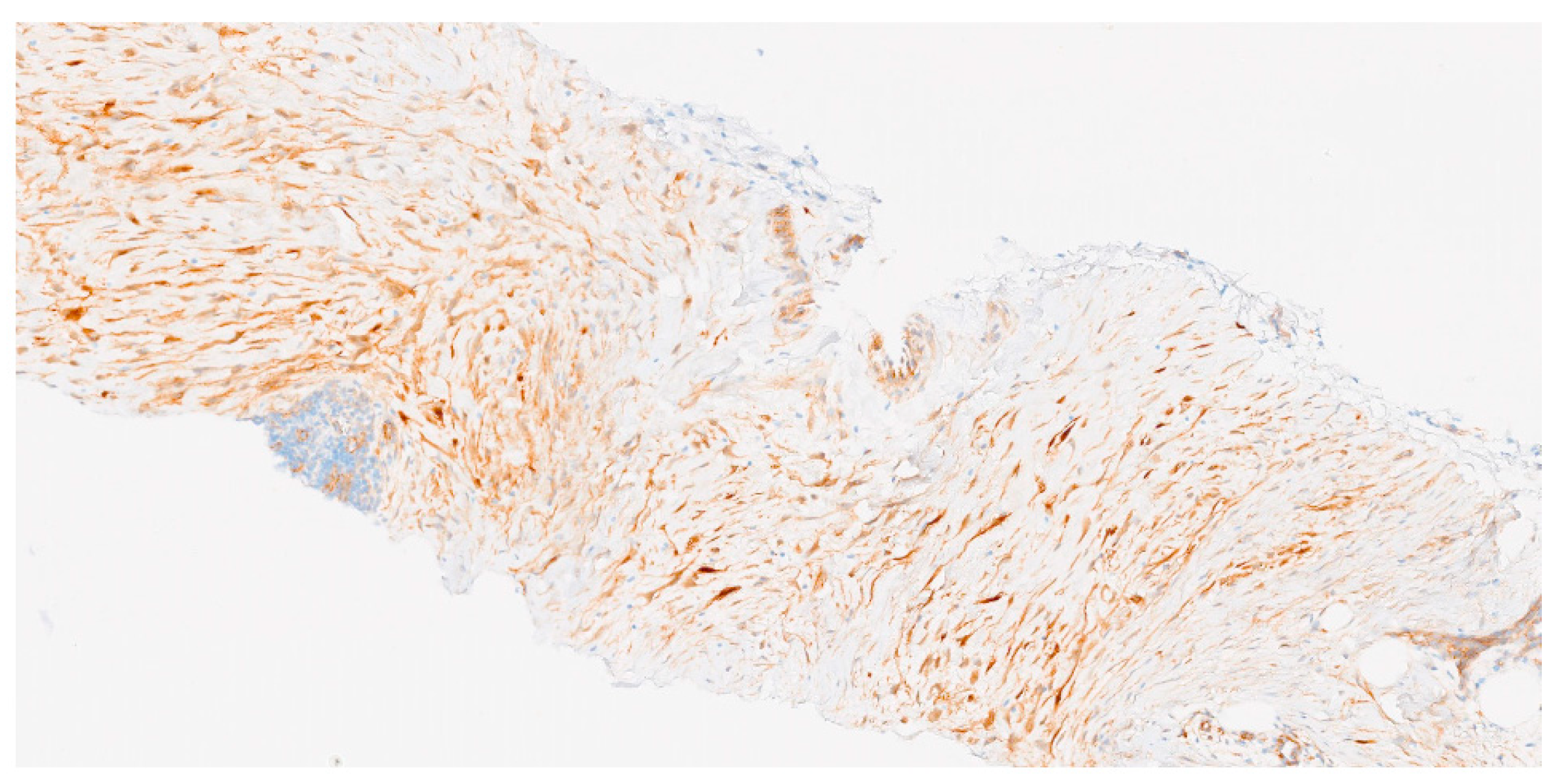 Cancers 17 03470 g003