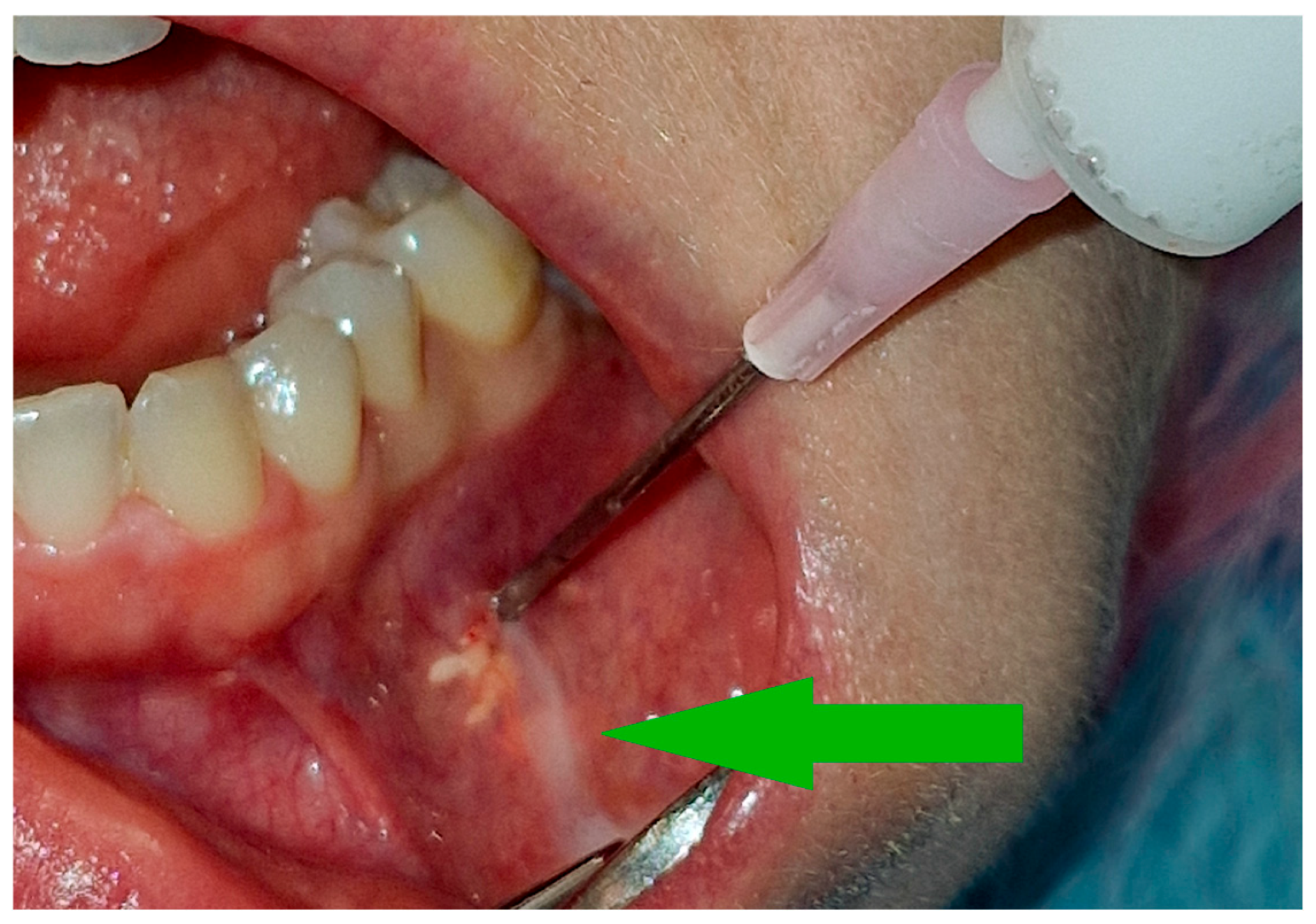 Cancers 17 03510 g002