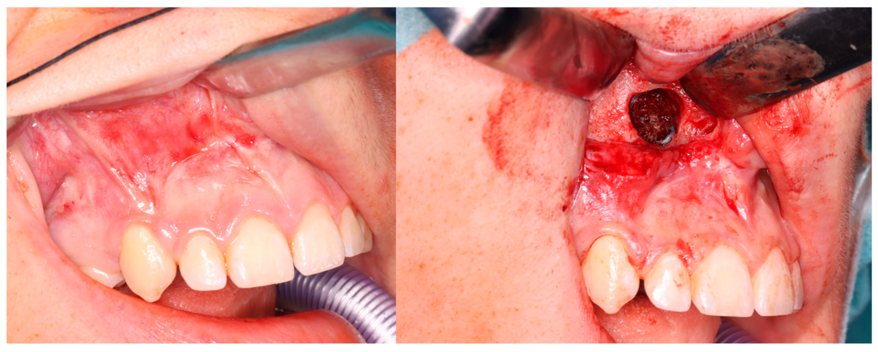 Cancers 17 03510 g004