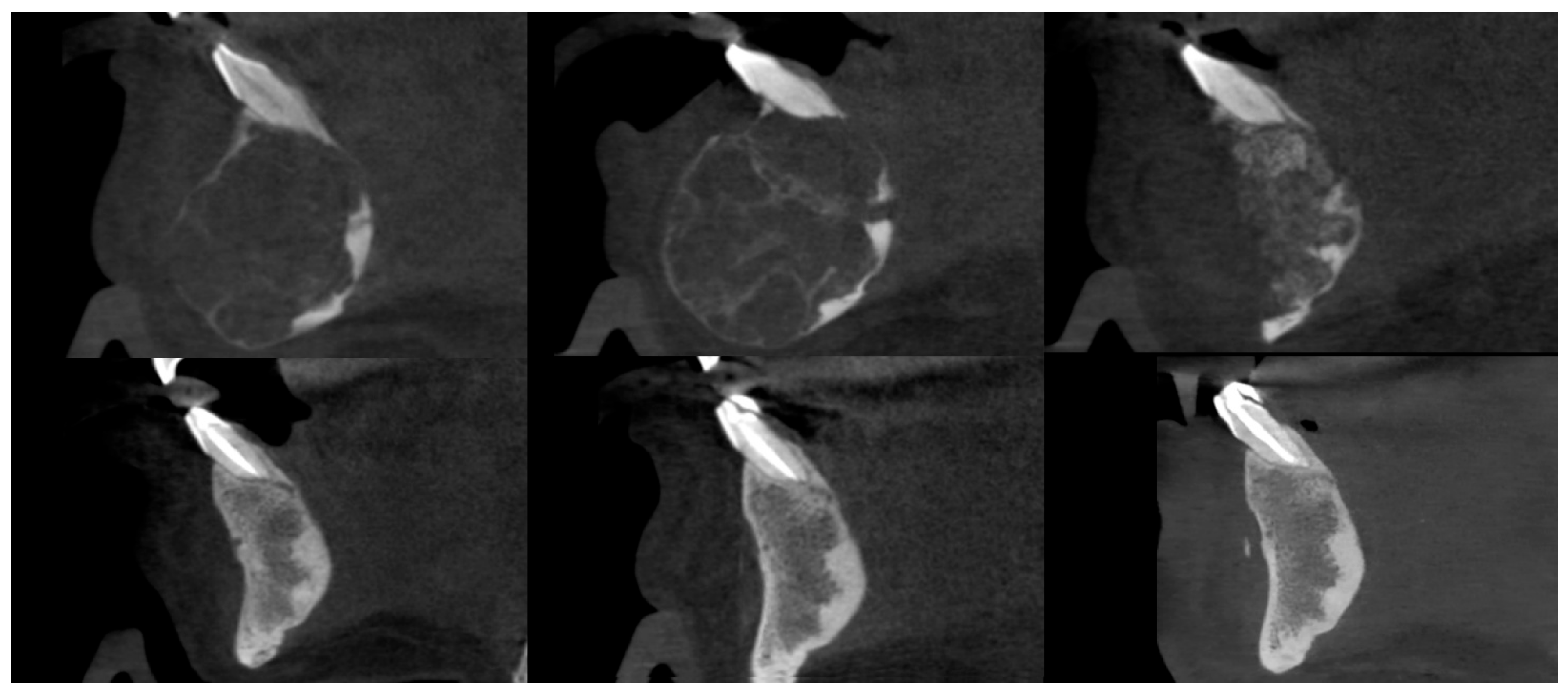 Cancers 17 03510 g006