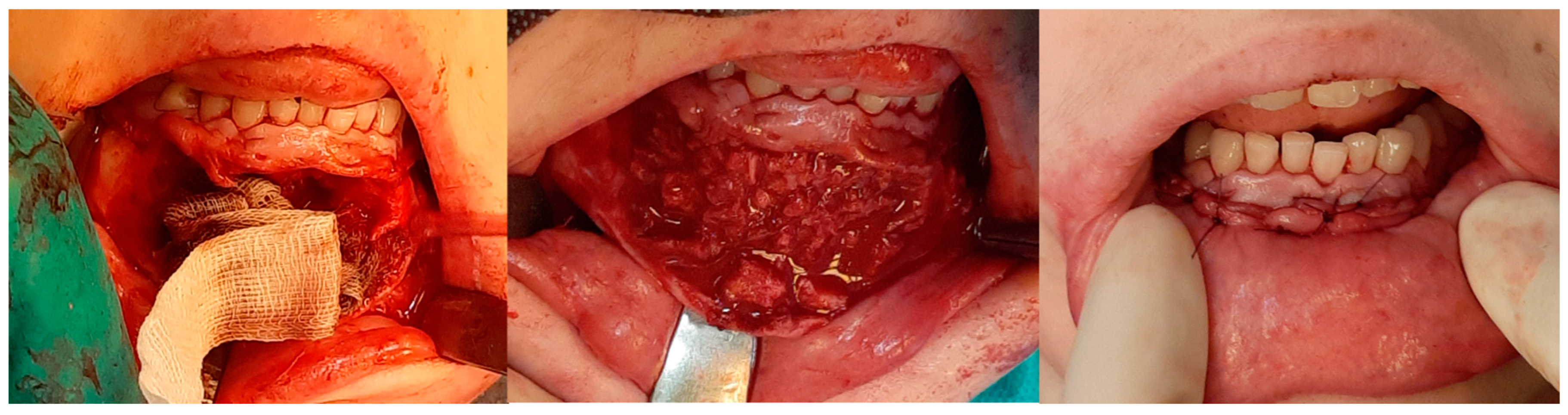 Cancers 17 03510 g010