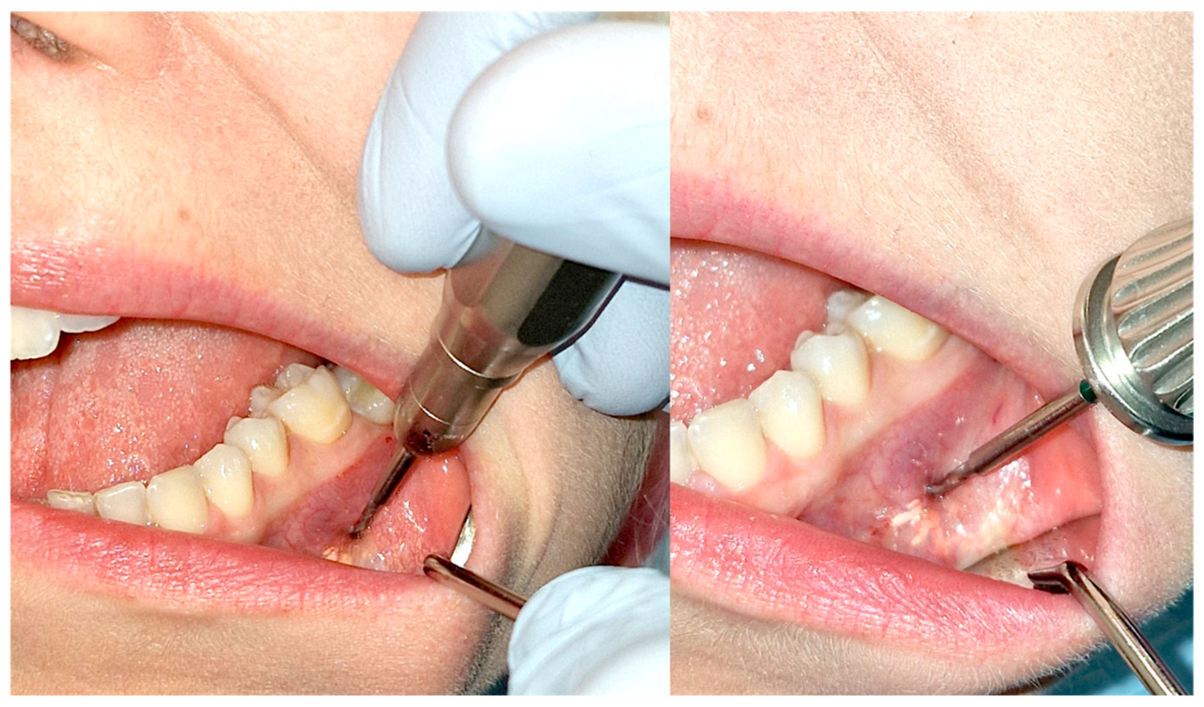 Cancers 17 03510 g011