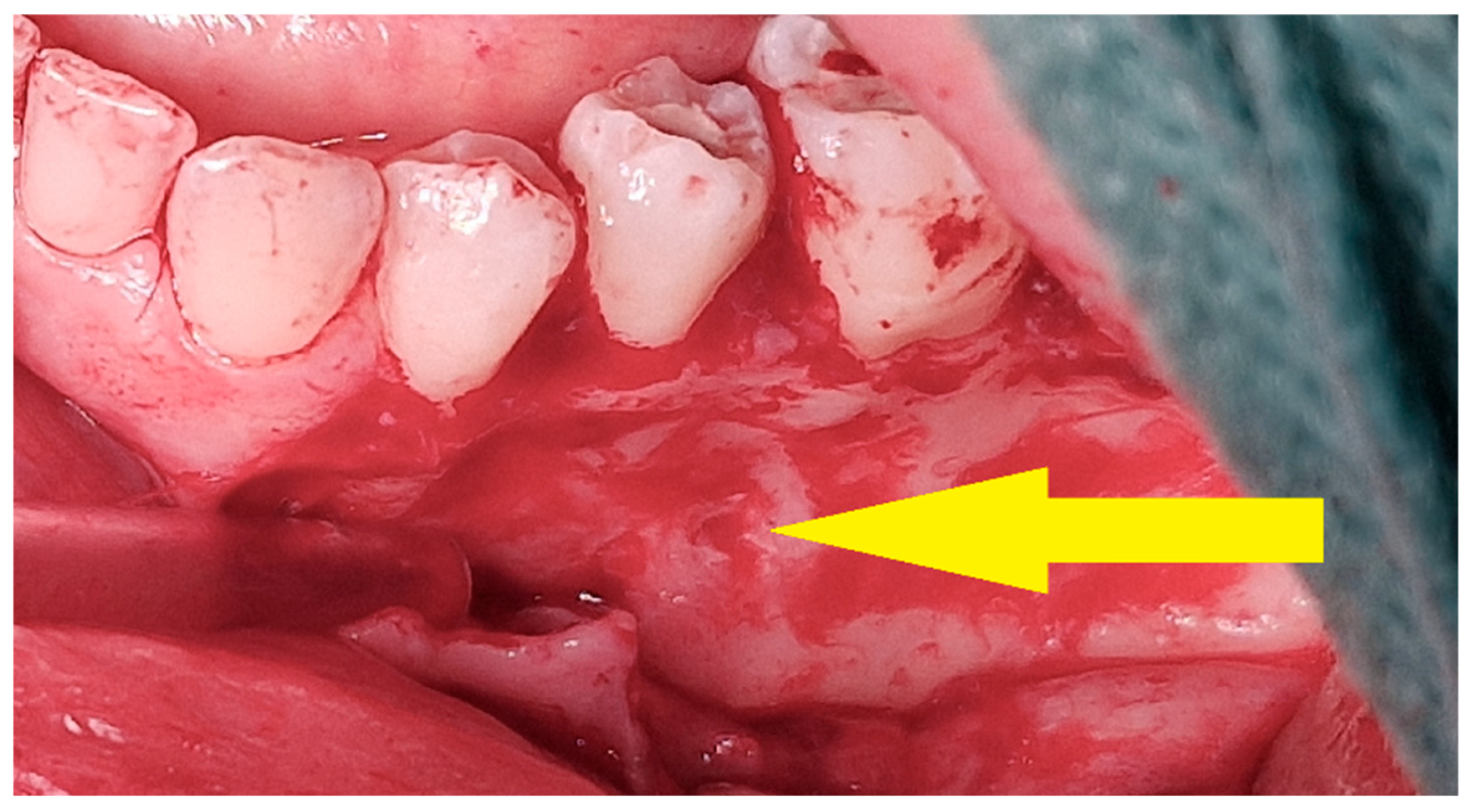 Cancers 17 03510 g012