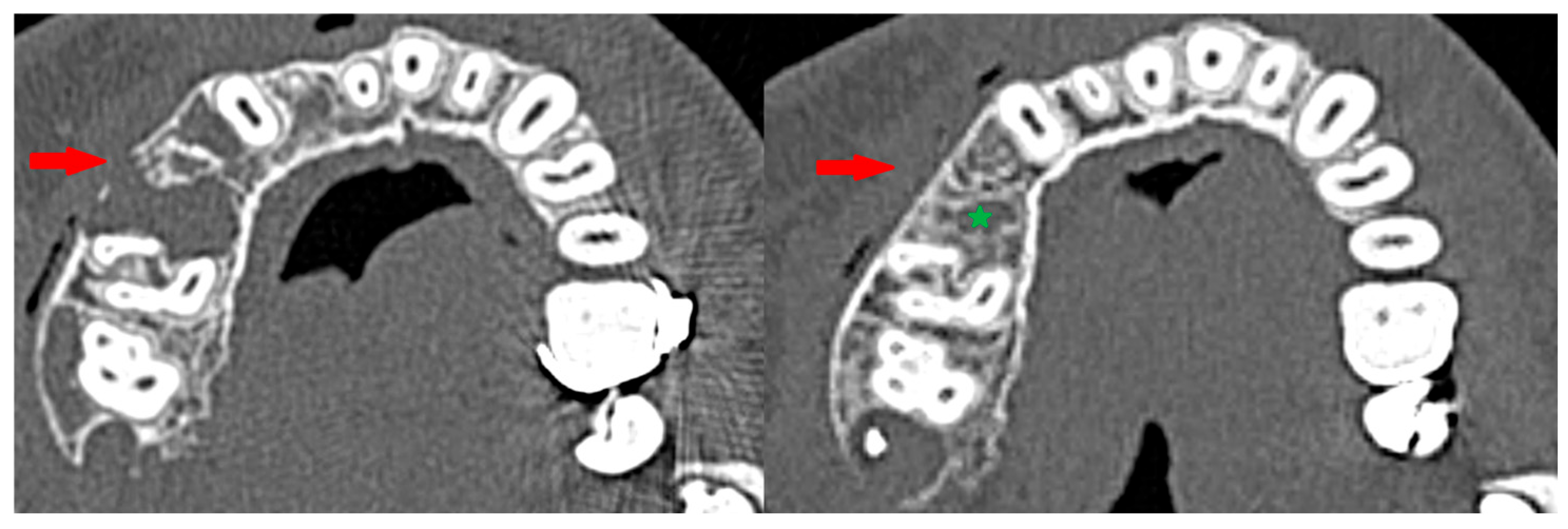 Cancers 17 03510 g013