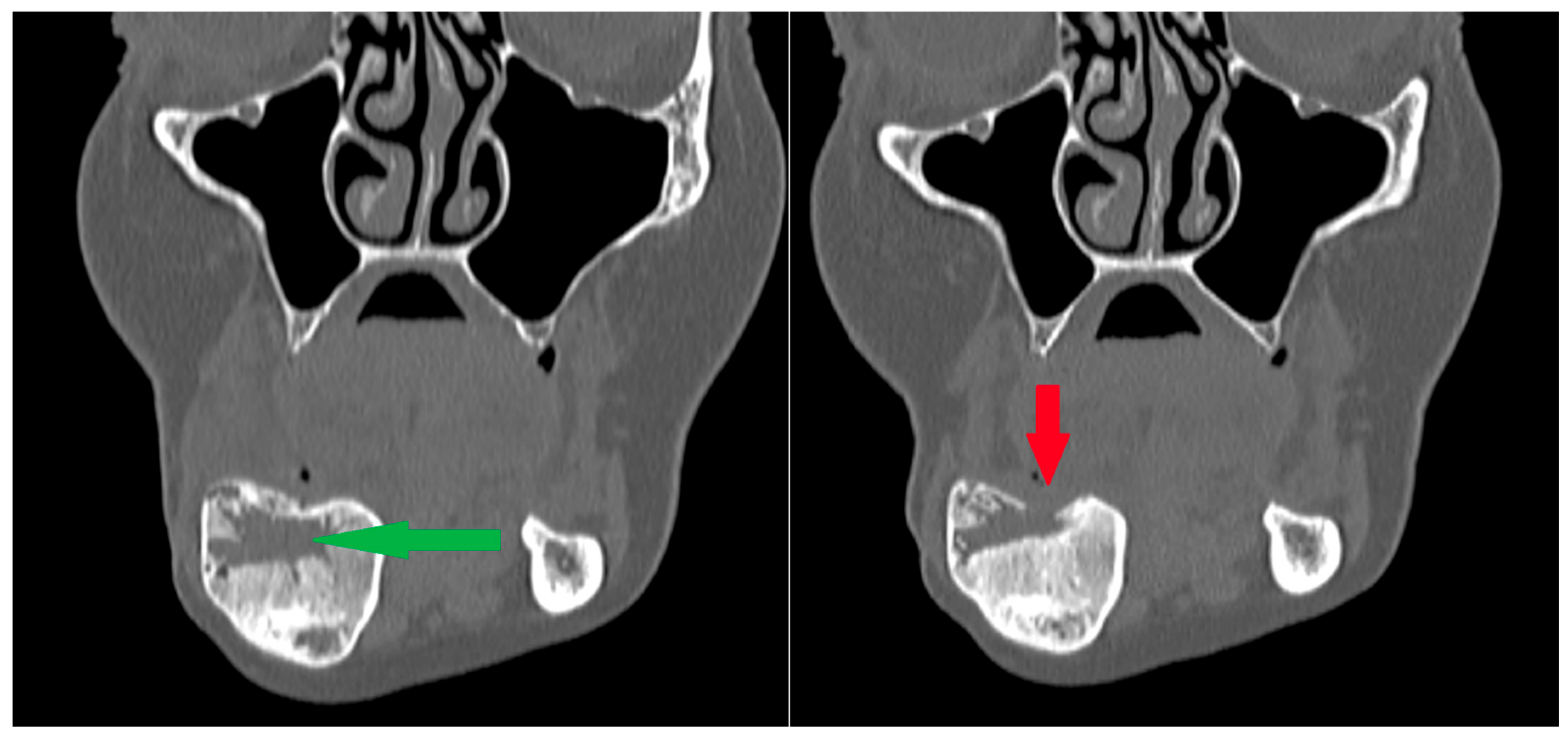 Cancers 17 03510 g014